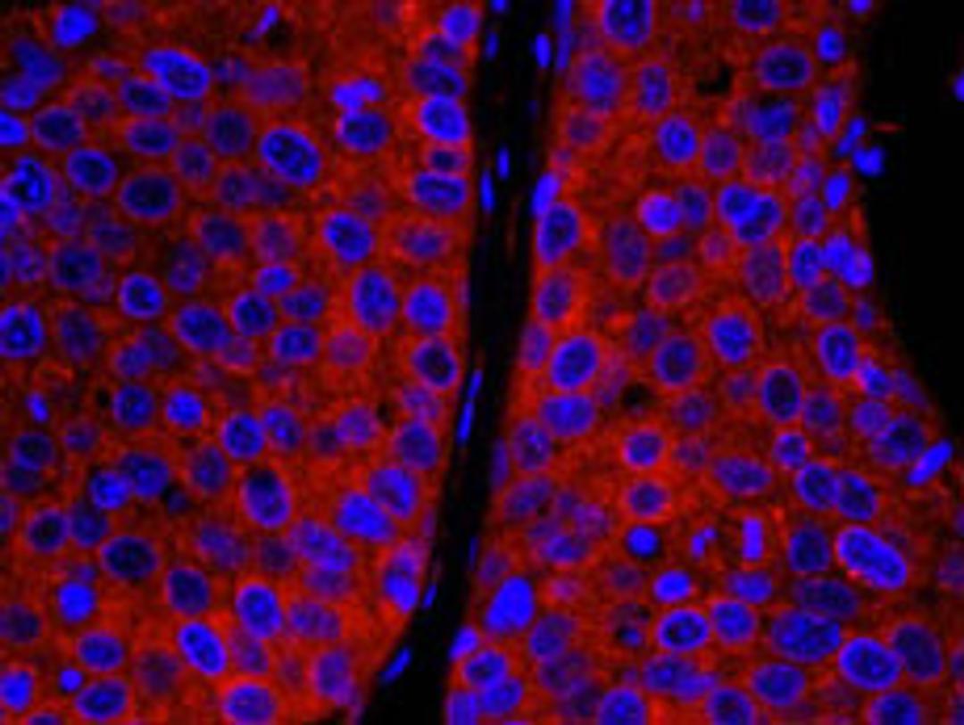 Detection of human CAD by immunohistochemistry.