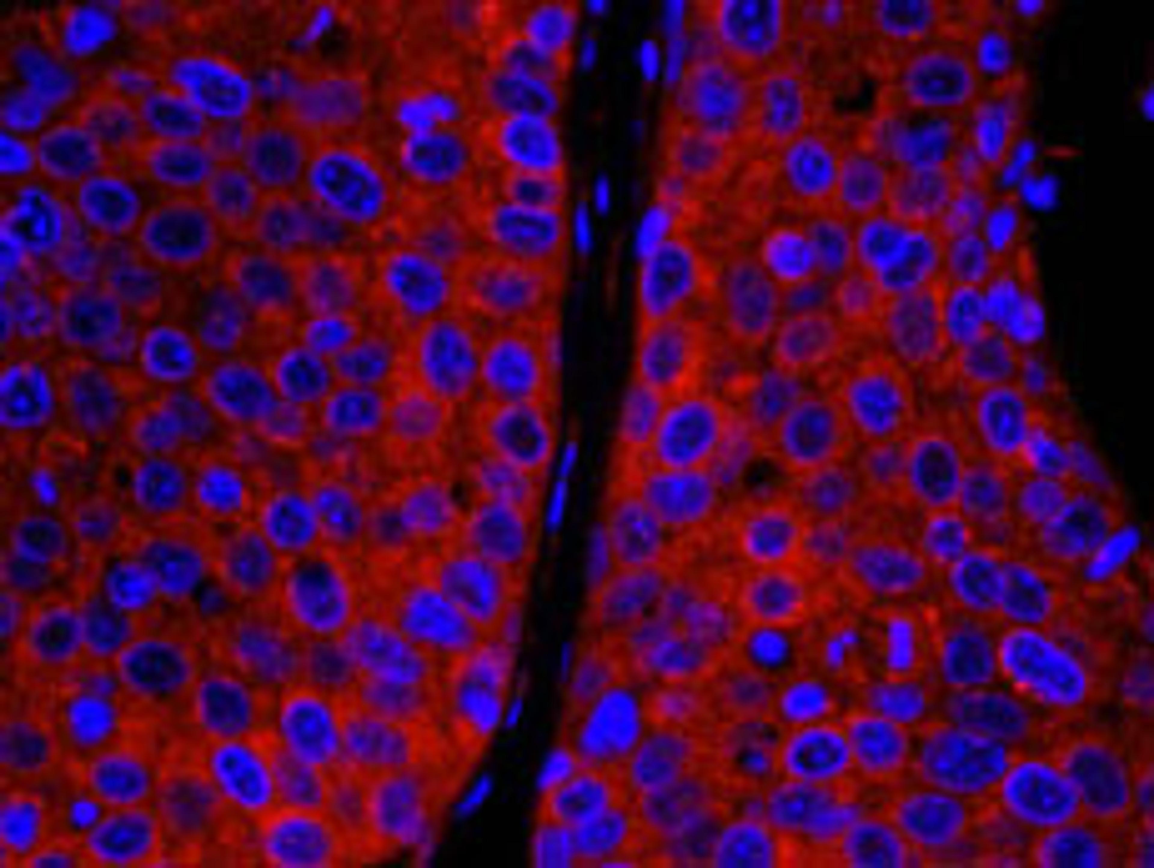 Detection of human CAD by immunohistochemistry.