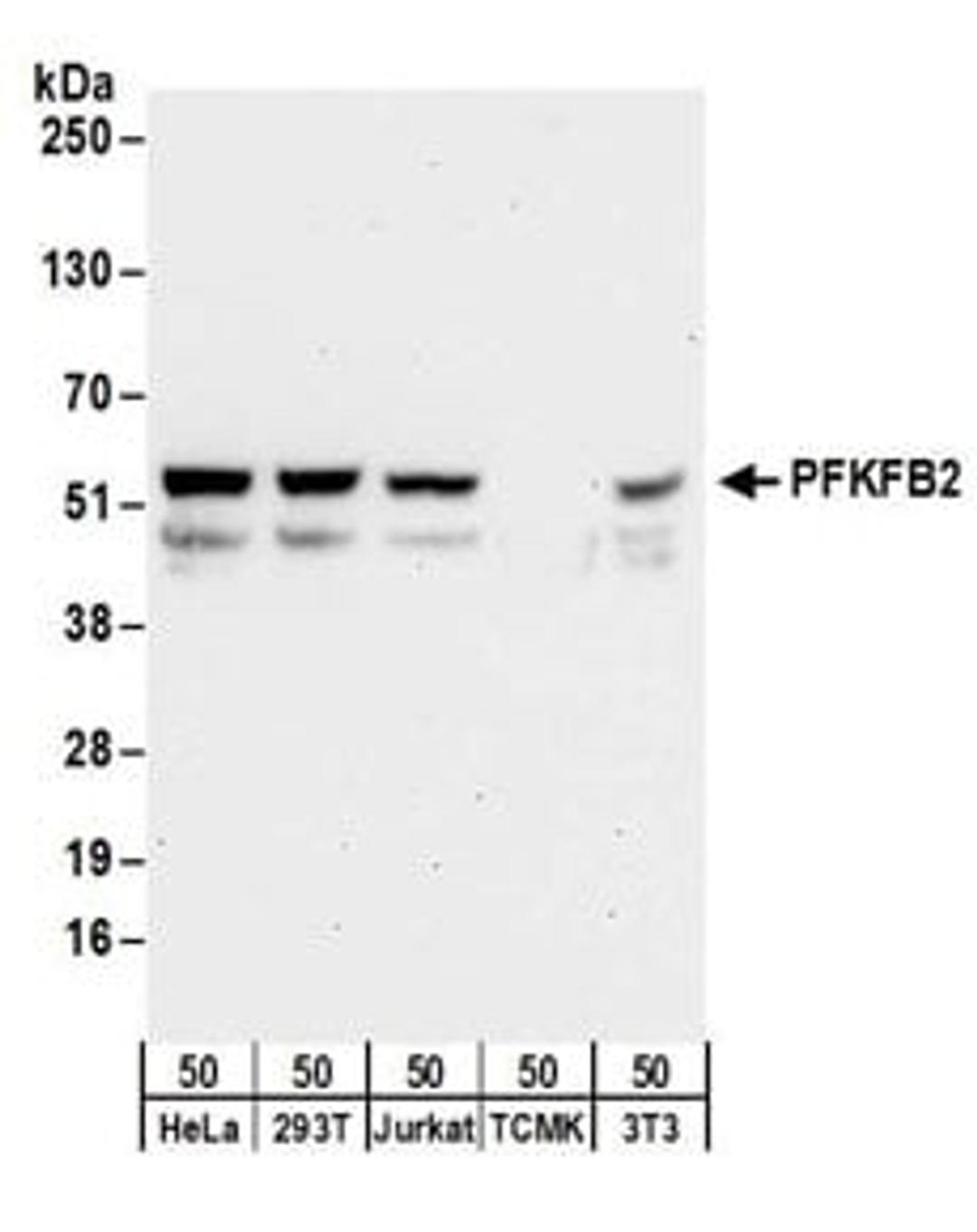 Detection of human and mouse PFKFB2 by western blot.