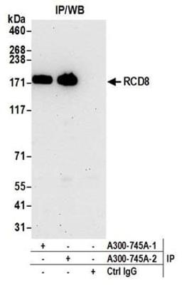 Detection of human RCD8 by western blot of immunoprecipitates.