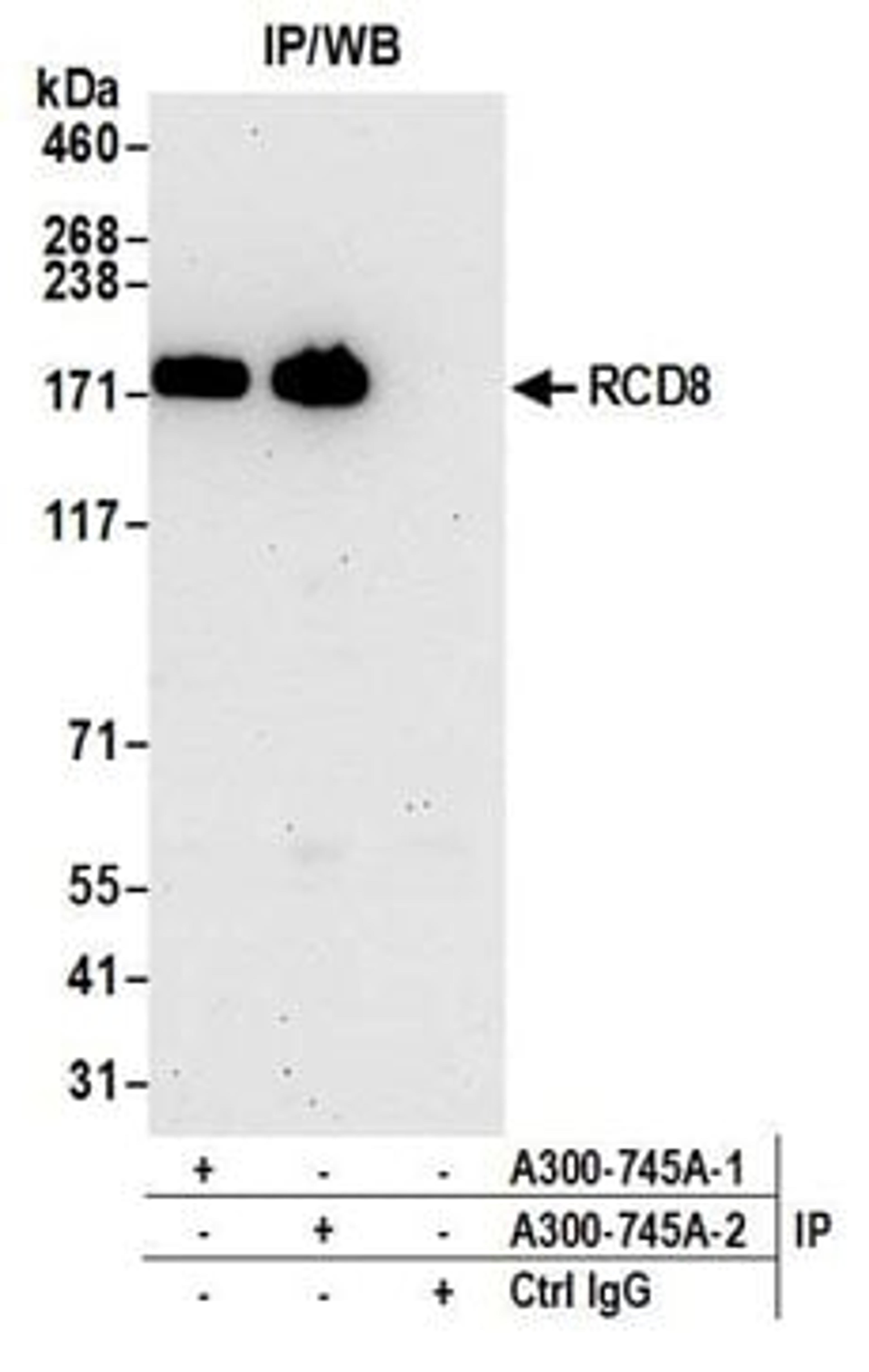 Detection of human RCD8 by western blot of immunoprecipitates.