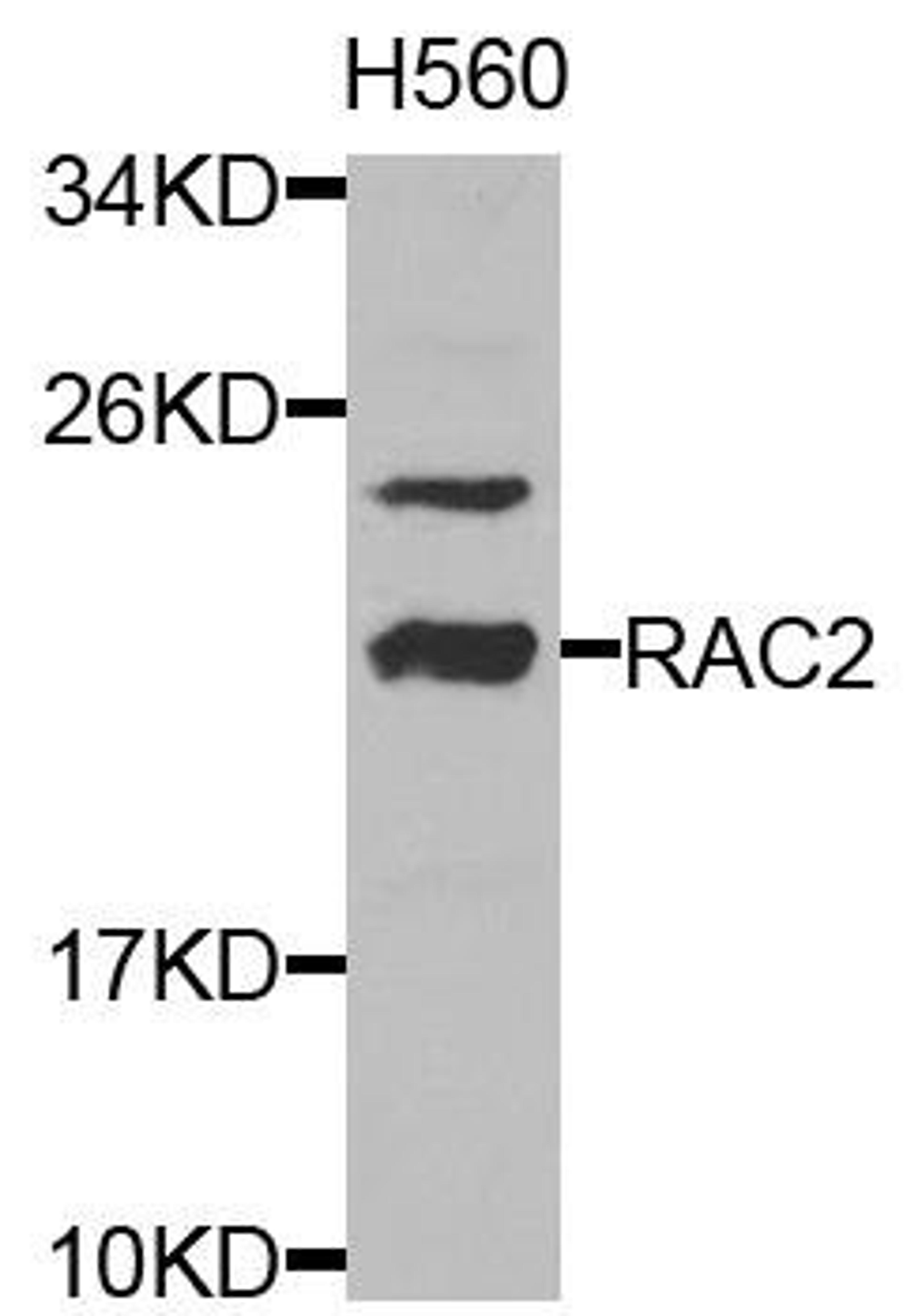 Western blot analysis of extracts of H560 cells using RAC2 antibody