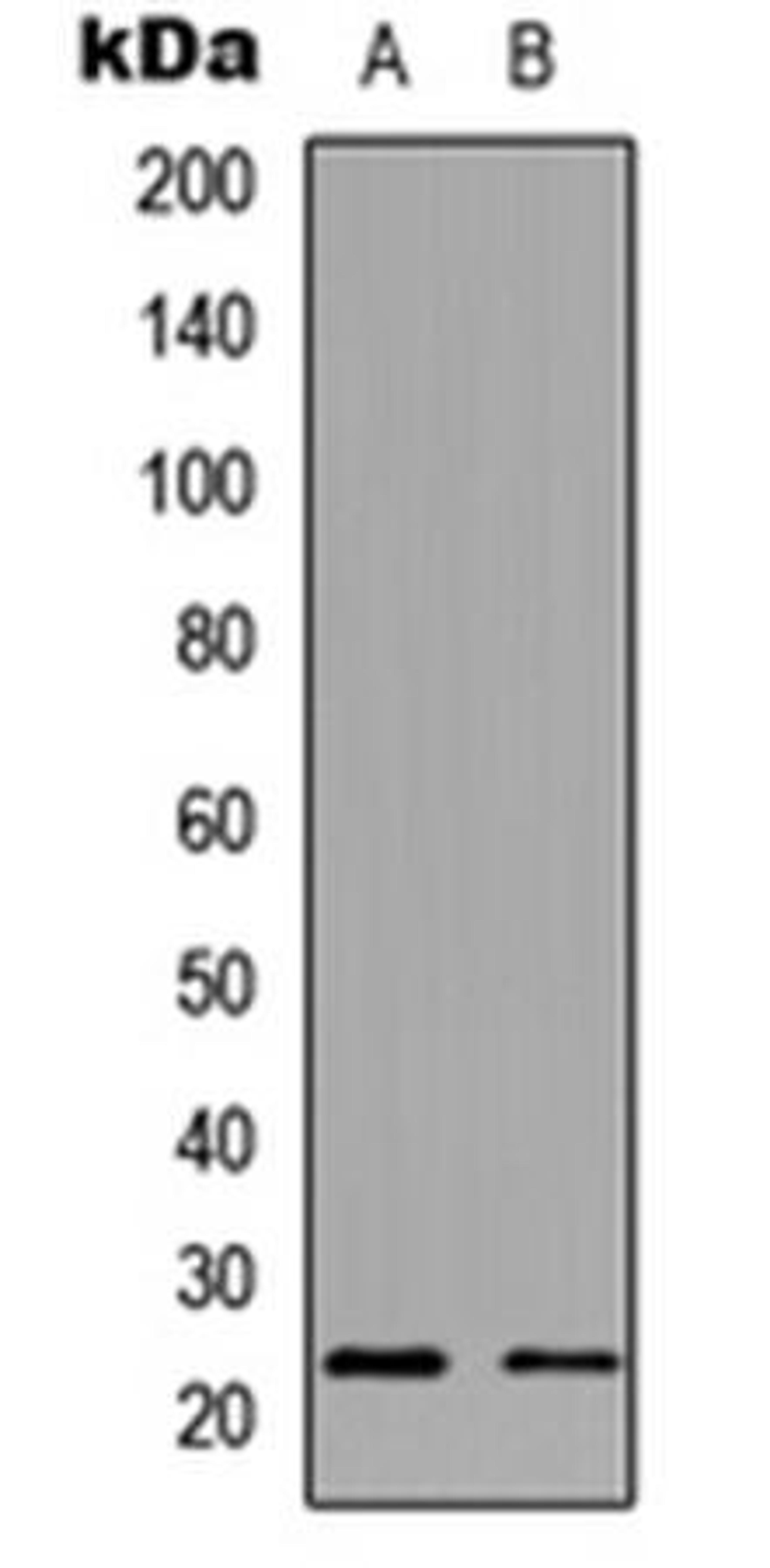 Western blot analysis of HeLa (Lane1), Jurkat (Lane2) whole cell using NDUFB9 antibody