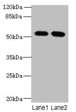 Western blot. All lanes: INTS14 antibody at 4µg/ml. Lane 1: Hela whole cell lysate. Lane 2: NIH/3T3 whole cell lysate. Secondary. Goat polyclonal to rabbit IgG at 1/10000 dilution. Predicted band size: 58, 10, 49, 51 kDa. Observed band size: 58 kDa