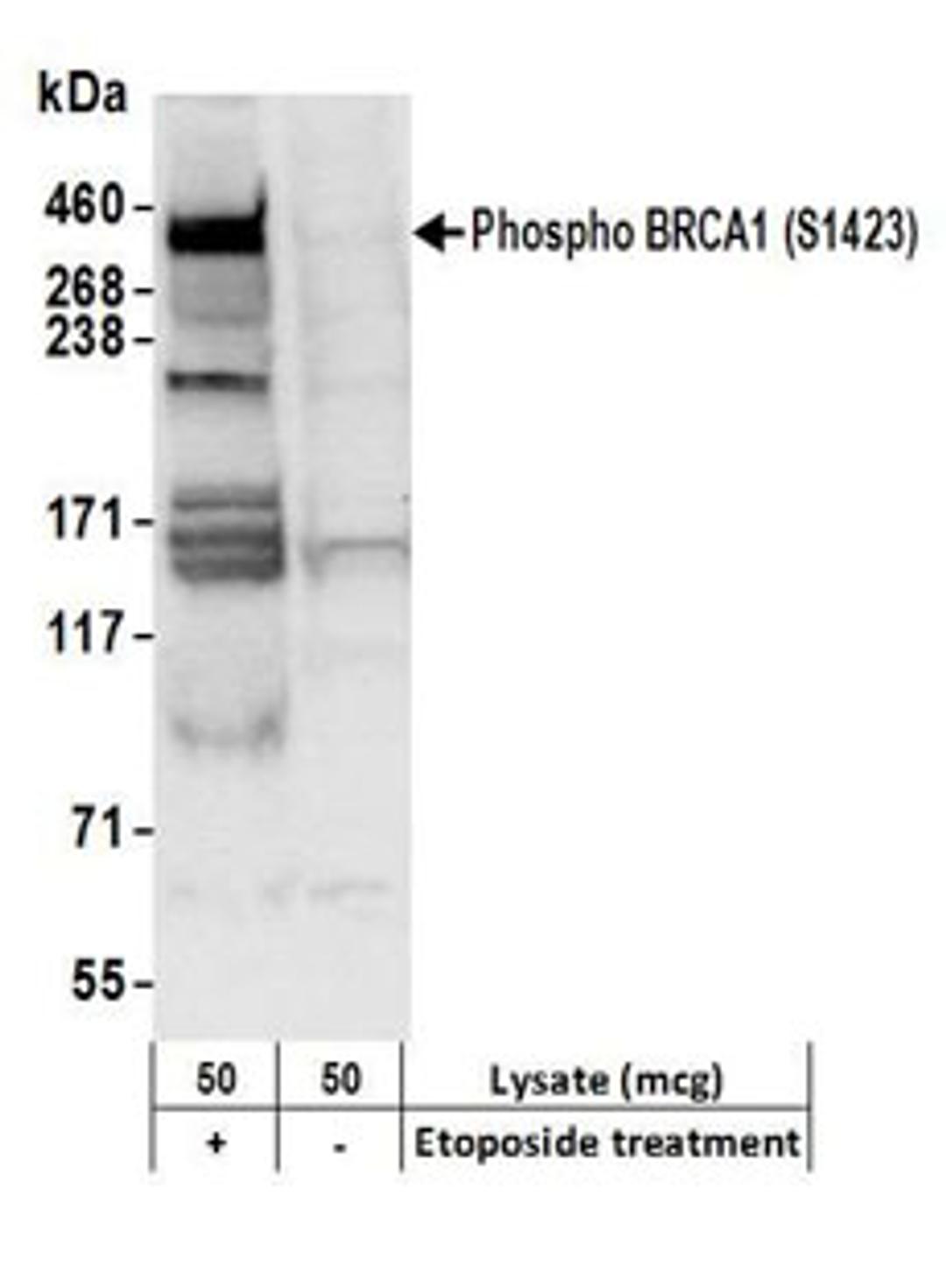 Detection of human Phospho BRCA1 (S1423) by western blot.