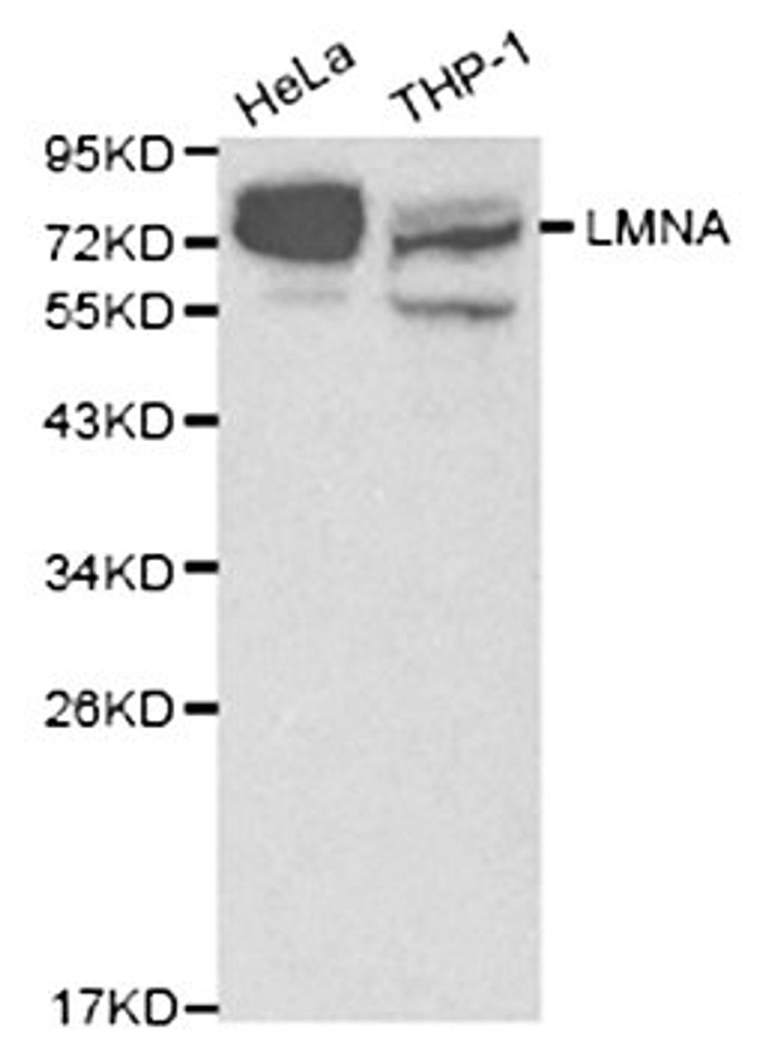 Western blot analysis of various cell lines using LMNA antibody.