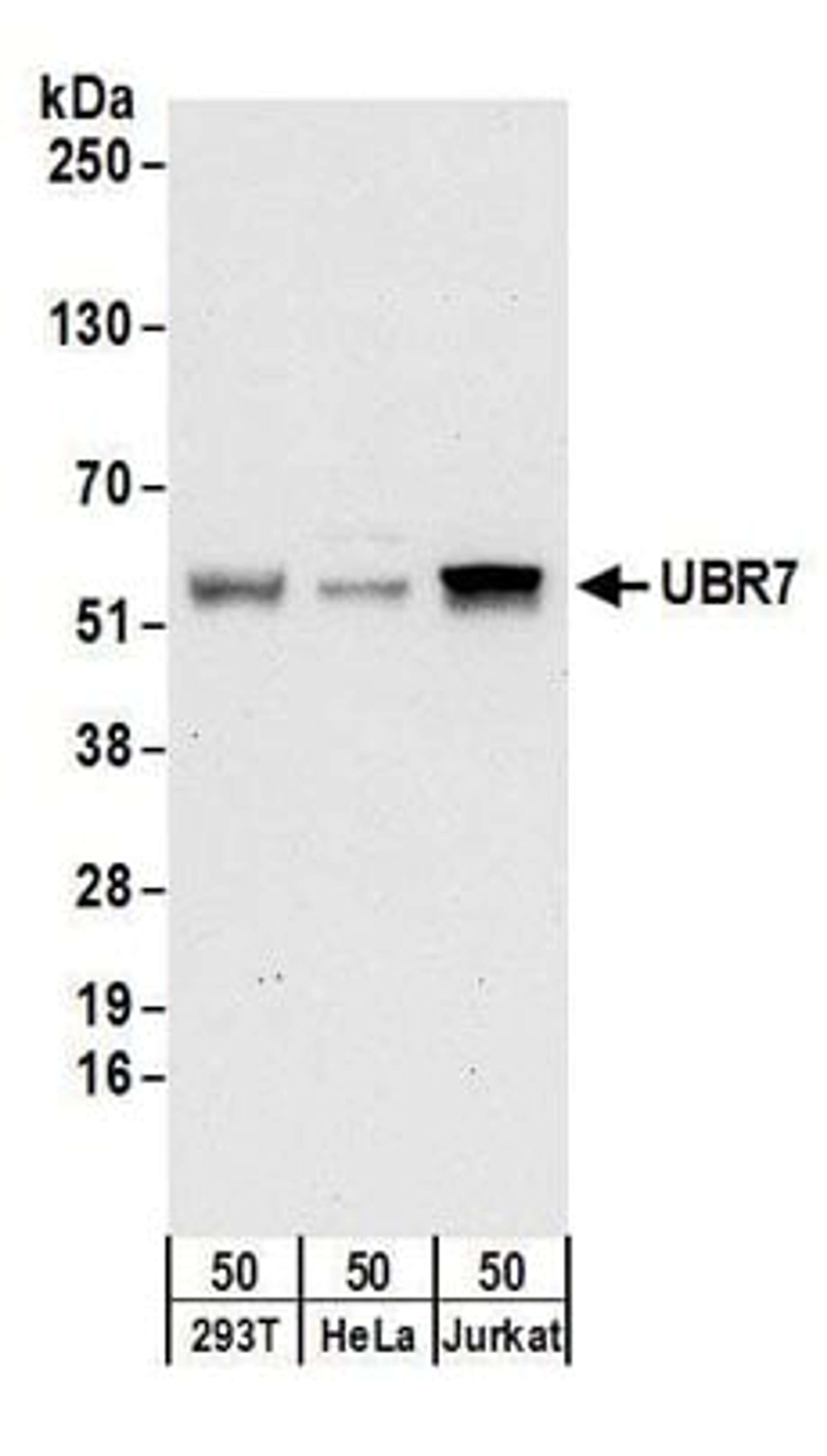 Detection of human UBR7 by western blot.