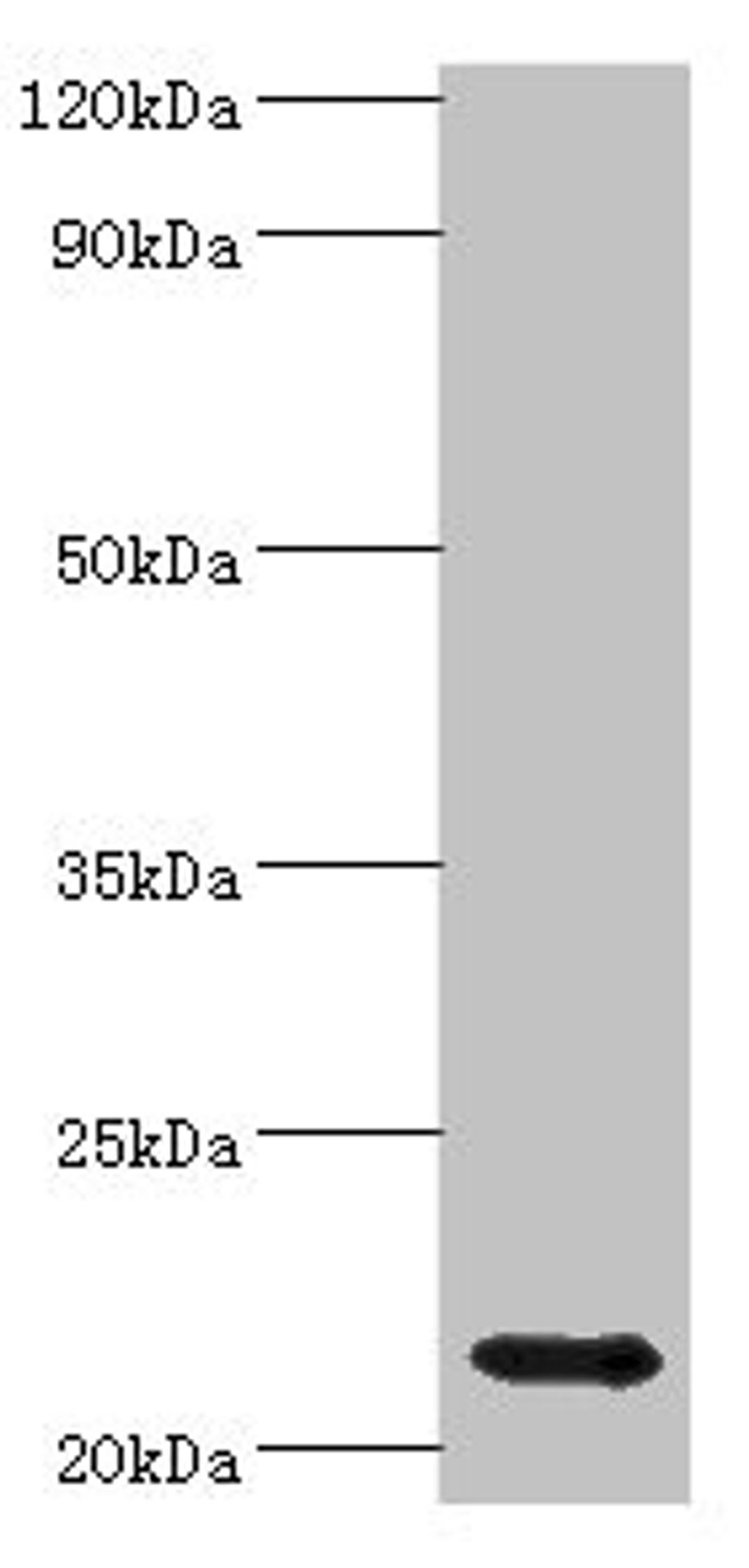 Western blot. All lanes: Heat shock protein beta-8 antibody at 4ug/ml + Rat heart tissue. Secondary. Goat polyclonal to rabbit IgG at 1/10000 dilution. Predicted band size: 22 kDa. Observed band size: 22 kDa.