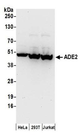 Detection of human ADE2 by western blot.