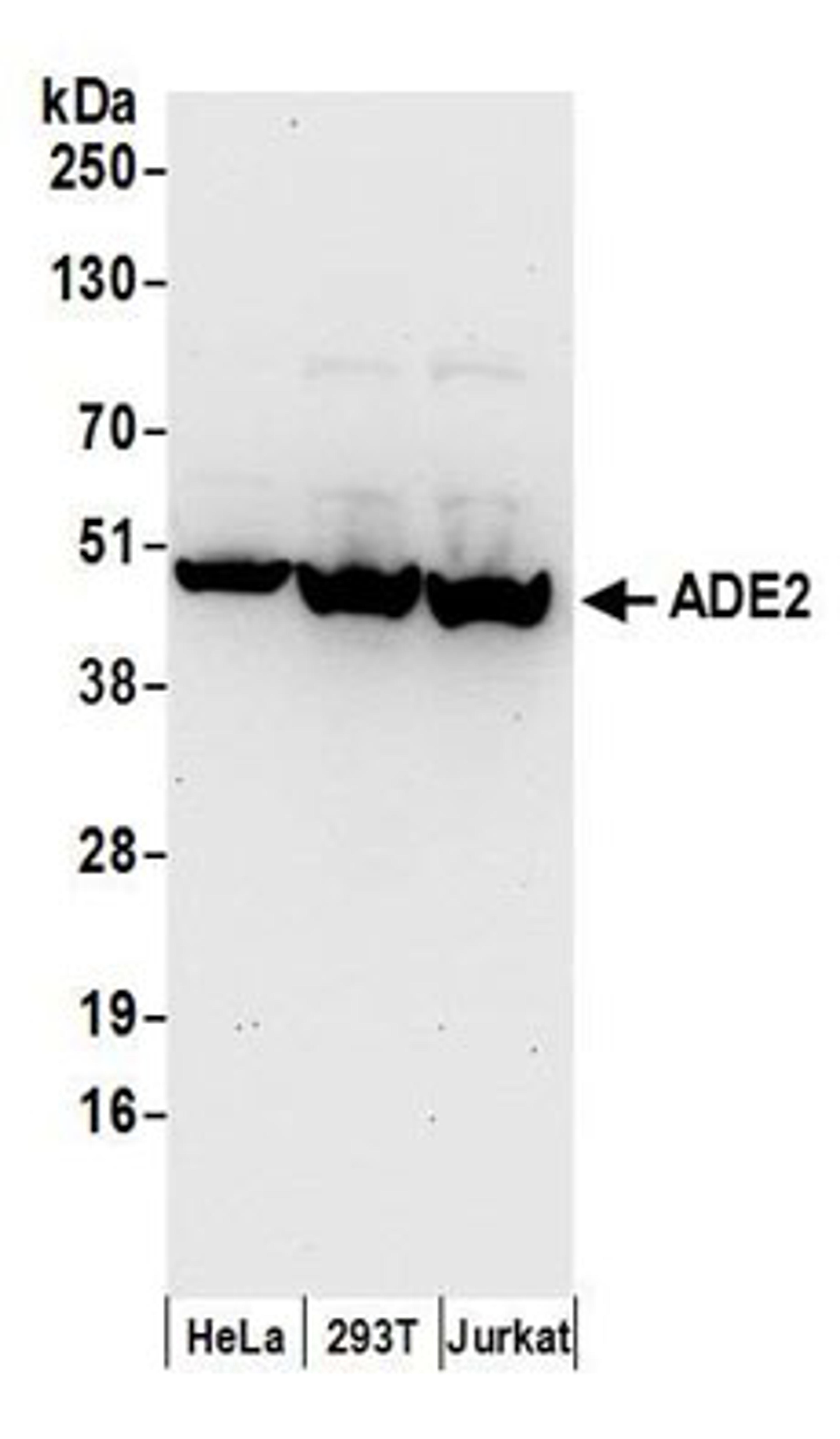 Detection of human ADE2 by western blot.