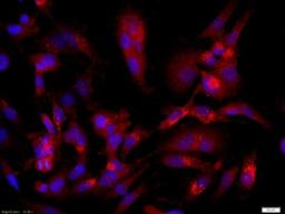 Immunohistochemical analysis of formalin-fixed paraffin embedded human glioma cells(U251 cells) tissue using CASPR antibody (dilution at 1:200)