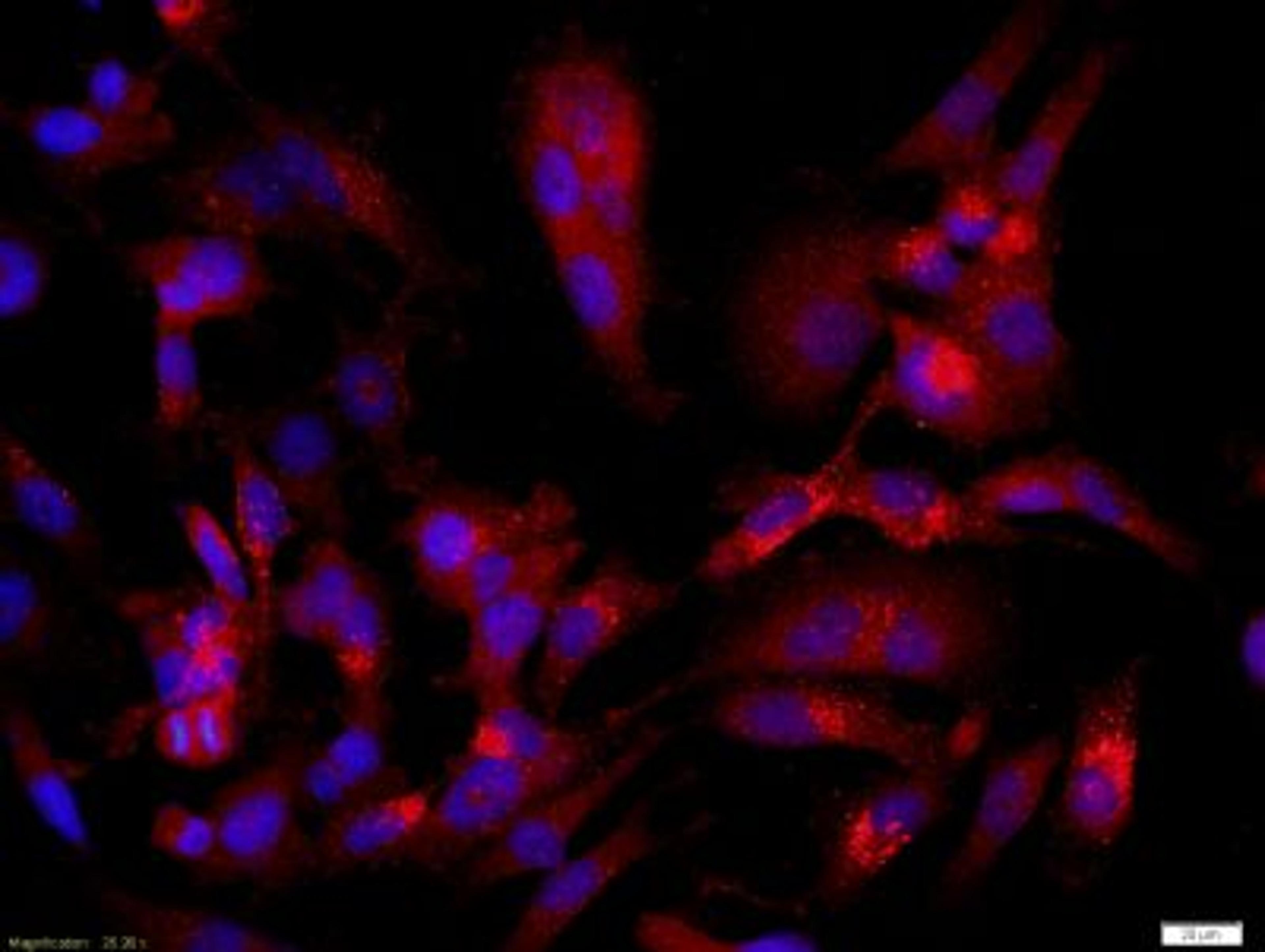 Immunohistochemical analysis of formalin-fixed paraffin embedded human glioma cells(U251 cells) tissue using CASPR antibody (dilution at 1:200)