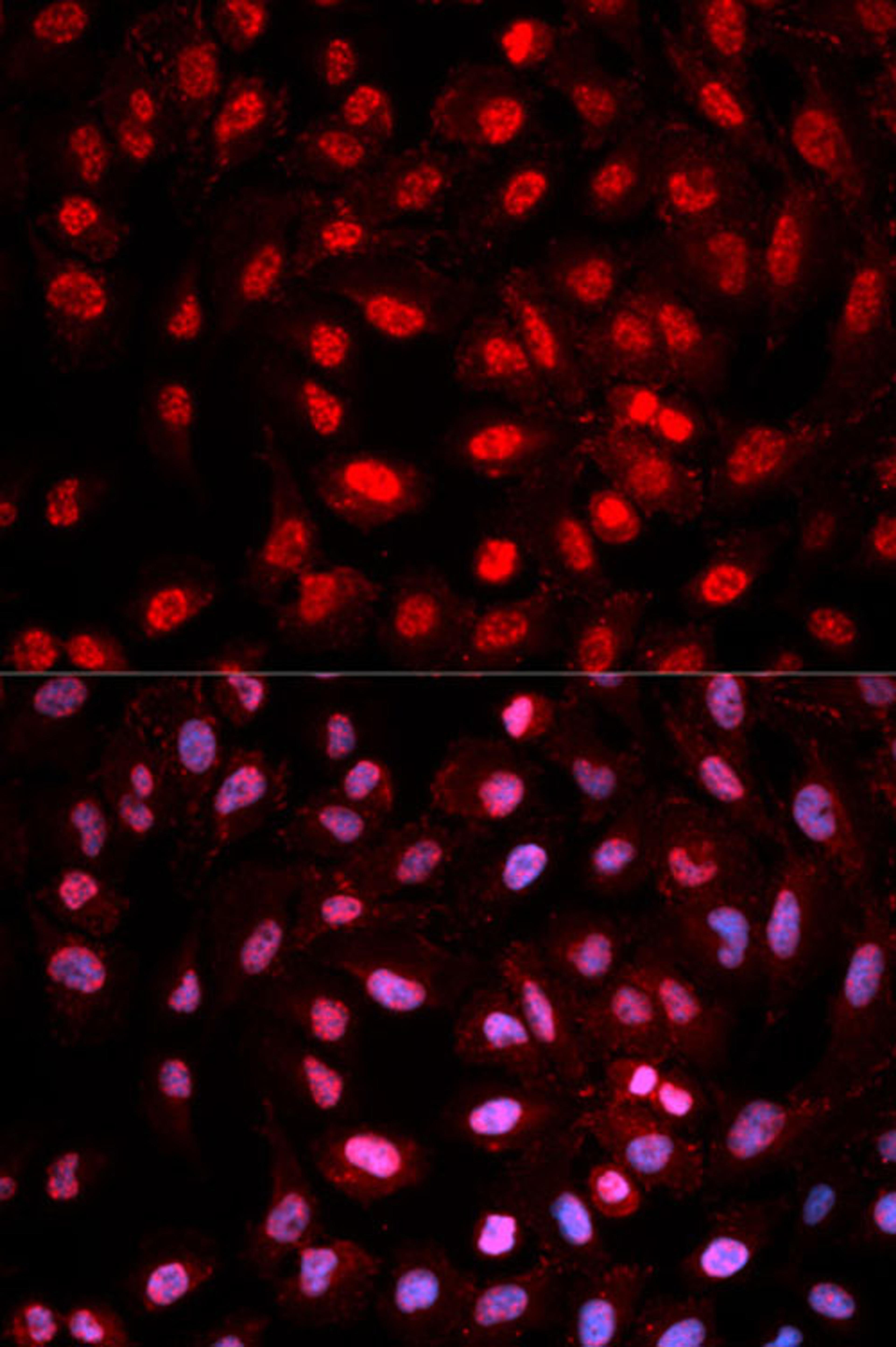 Immunofluorescence - Phospho-Dnmt1-pY399 antibody (AP0022)