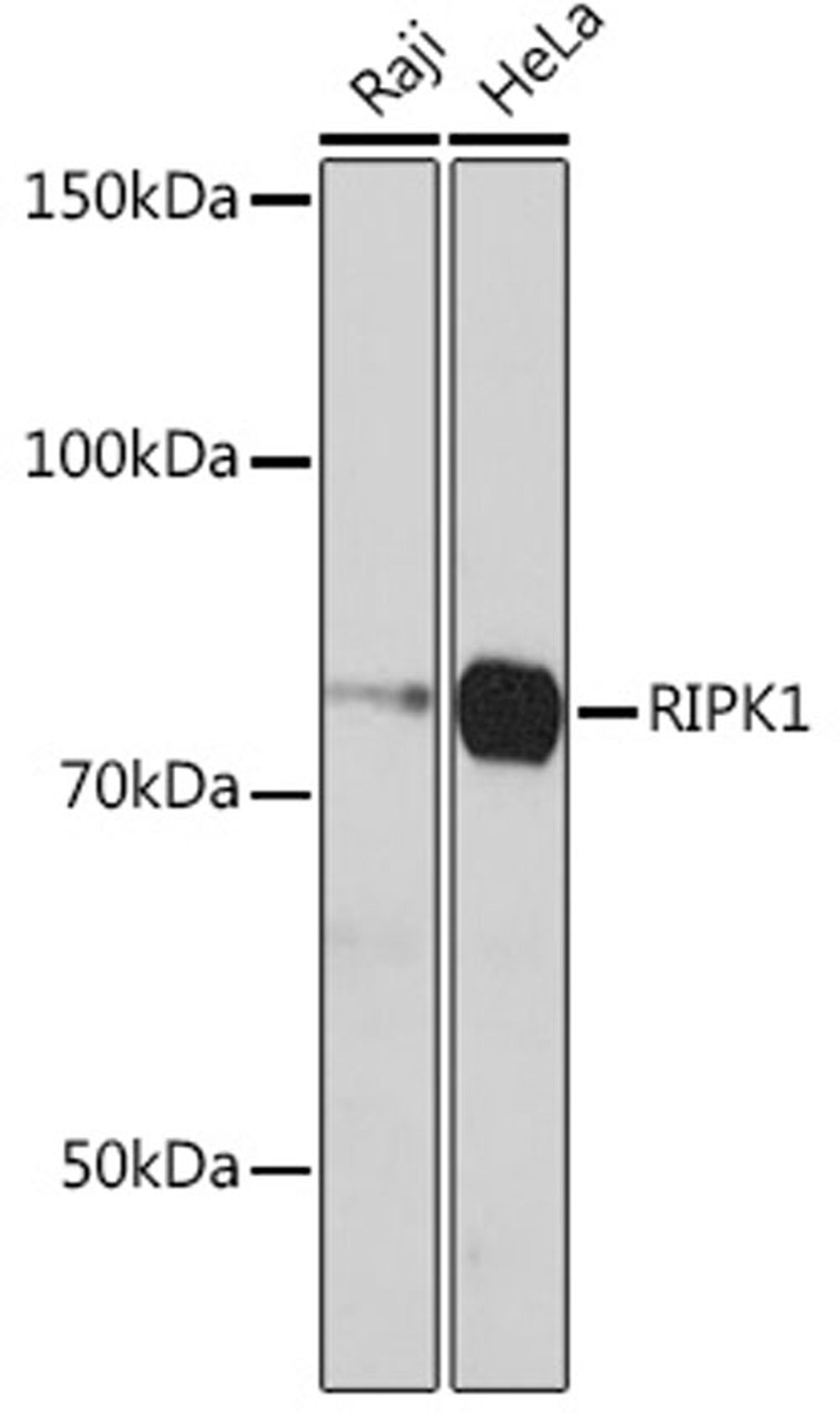 Western blot - RIPK1 antibody (A19580)