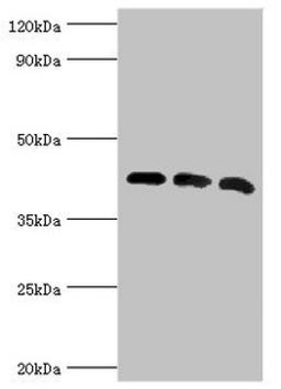 Western blot. All lanes: Alpha-centractin antibody at 8ug/ml. Lane 1: Mouse brain tissue. Lane 2: MCF-7 whole cell lysate. Lane 3: Mouse liver tissue. Secondary. Goat polyclonal to rabbit IgG at 1/10000 dilution. Predicted band size: 43 kDa. Observed band size: 43 kDa. 