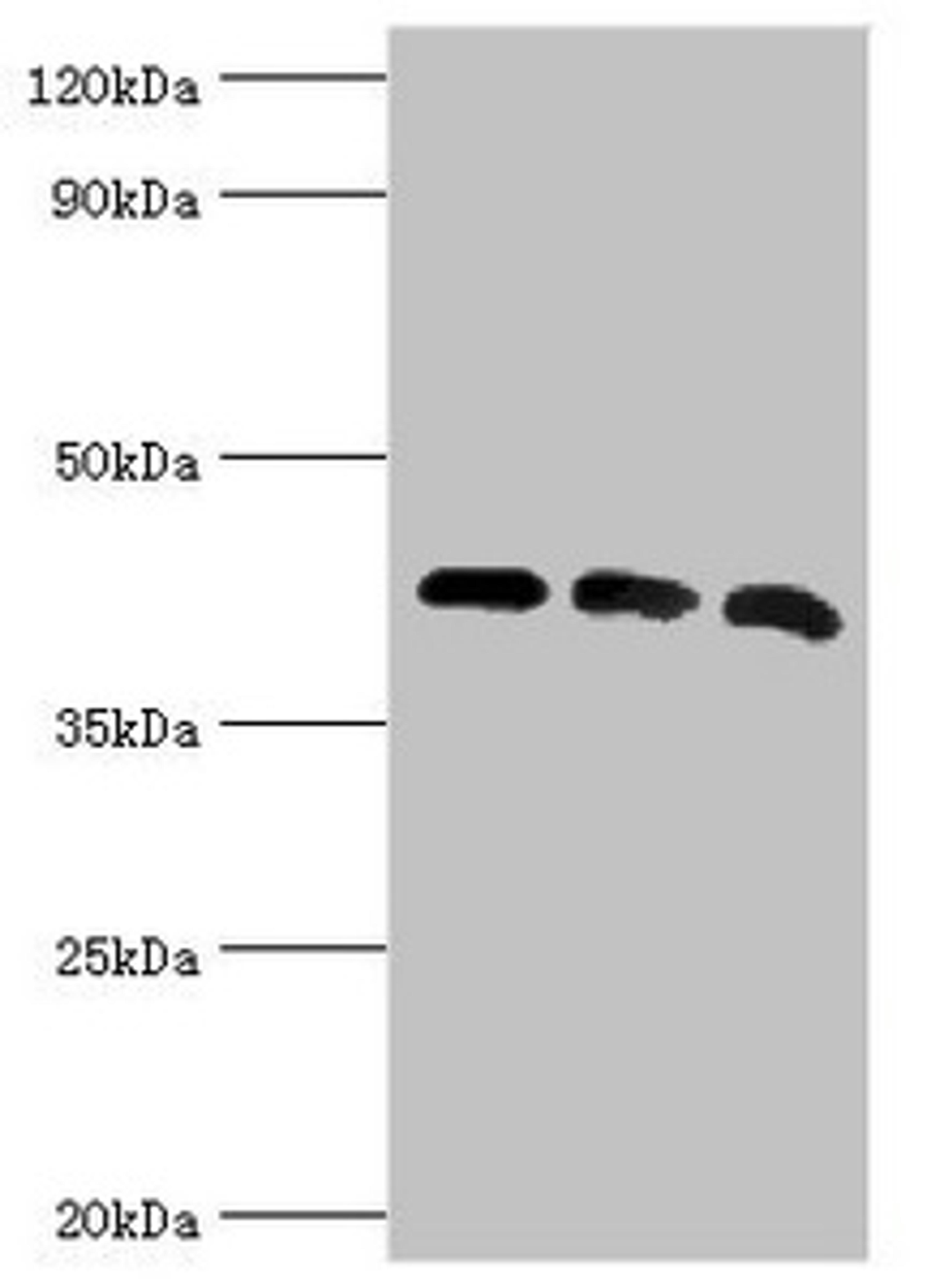Western blot. All lanes: Alpha-centractin antibody at 8ug/ml. Lane 1: Mouse brain tissue. Lane 2: MCF-7 whole cell lysate. Lane 3: Mouse liver tissue. Secondary. Goat polyclonal to rabbit IgG at 1/10000 dilution. Predicted band size: 43 kDa. Observed band size: 43 kDa. 