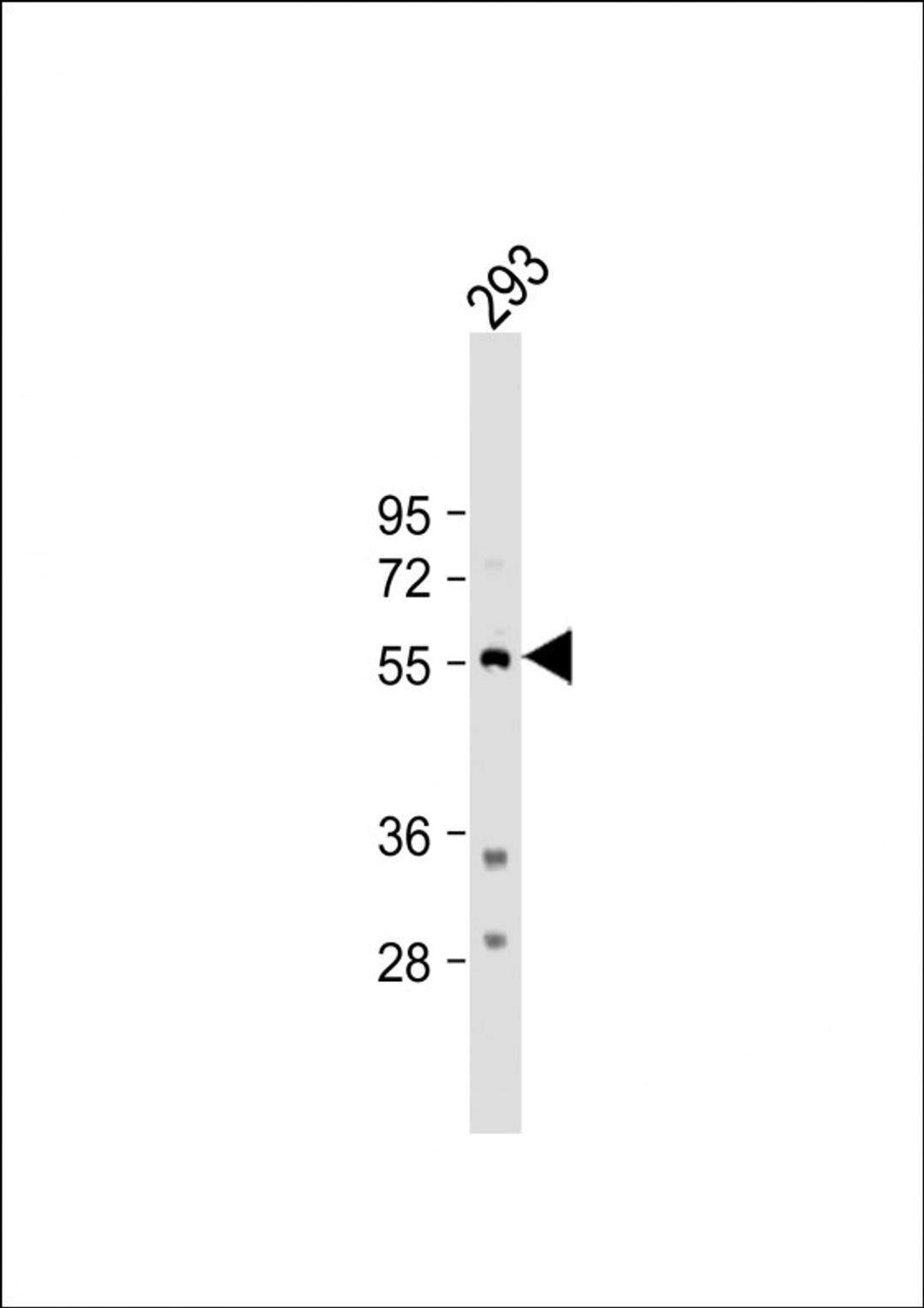 Western Blot at 1:500 dilution + 293 whole cell lysate Lysates/proteins at 20 ug per lane.