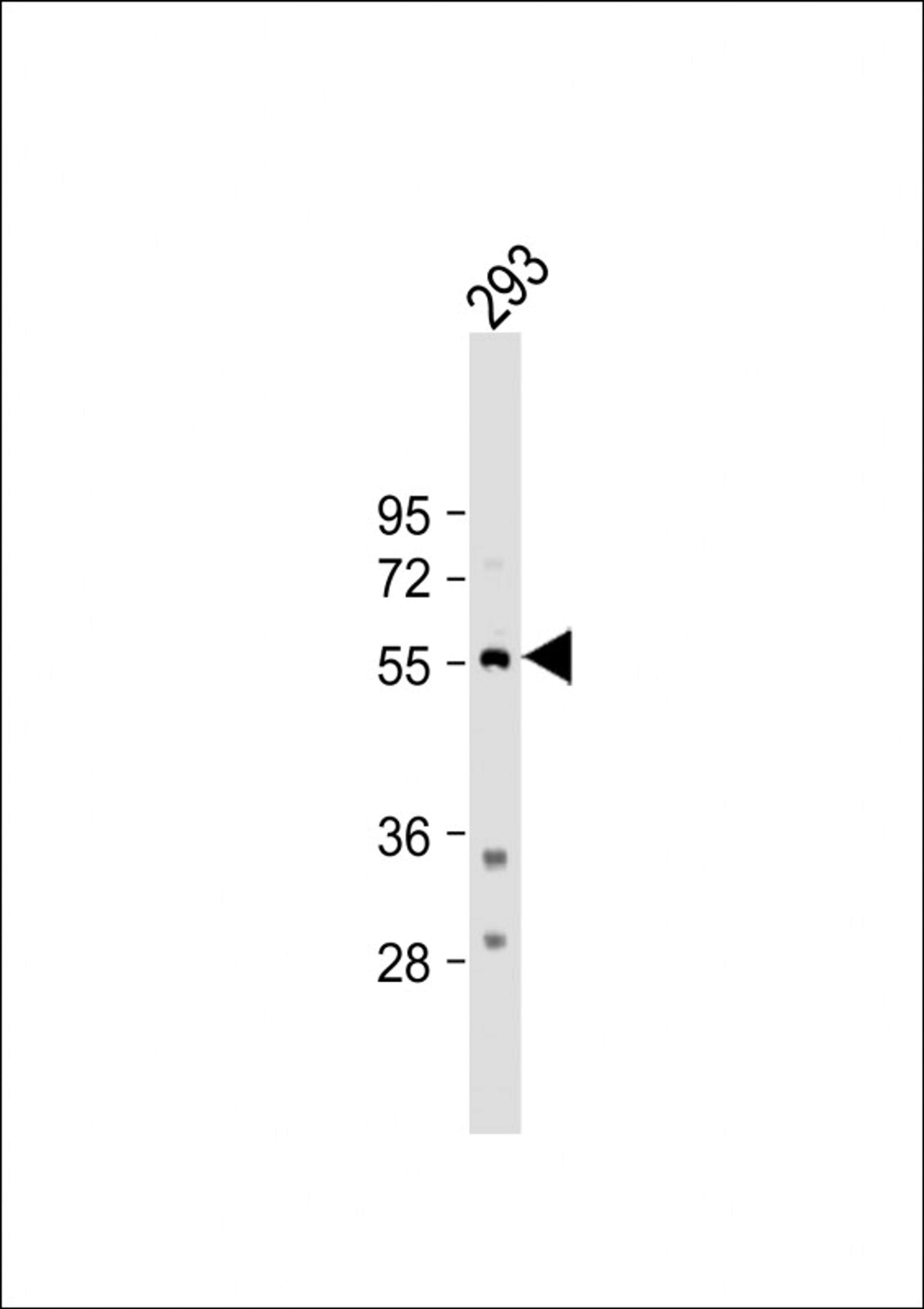 Western Blot at 1:500 dilution + 293 whole cell lysate Lysates/proteins at 20 ug per lane.