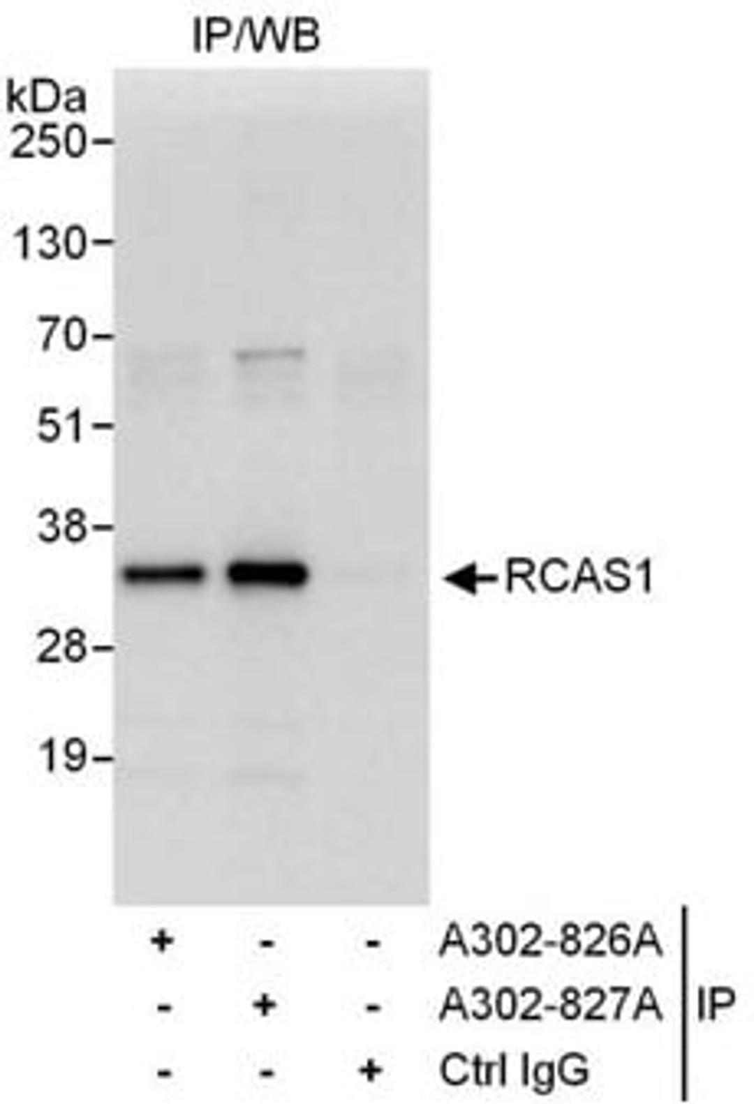 Detection of human RCAS1 by western blot of immunoprecipitates.