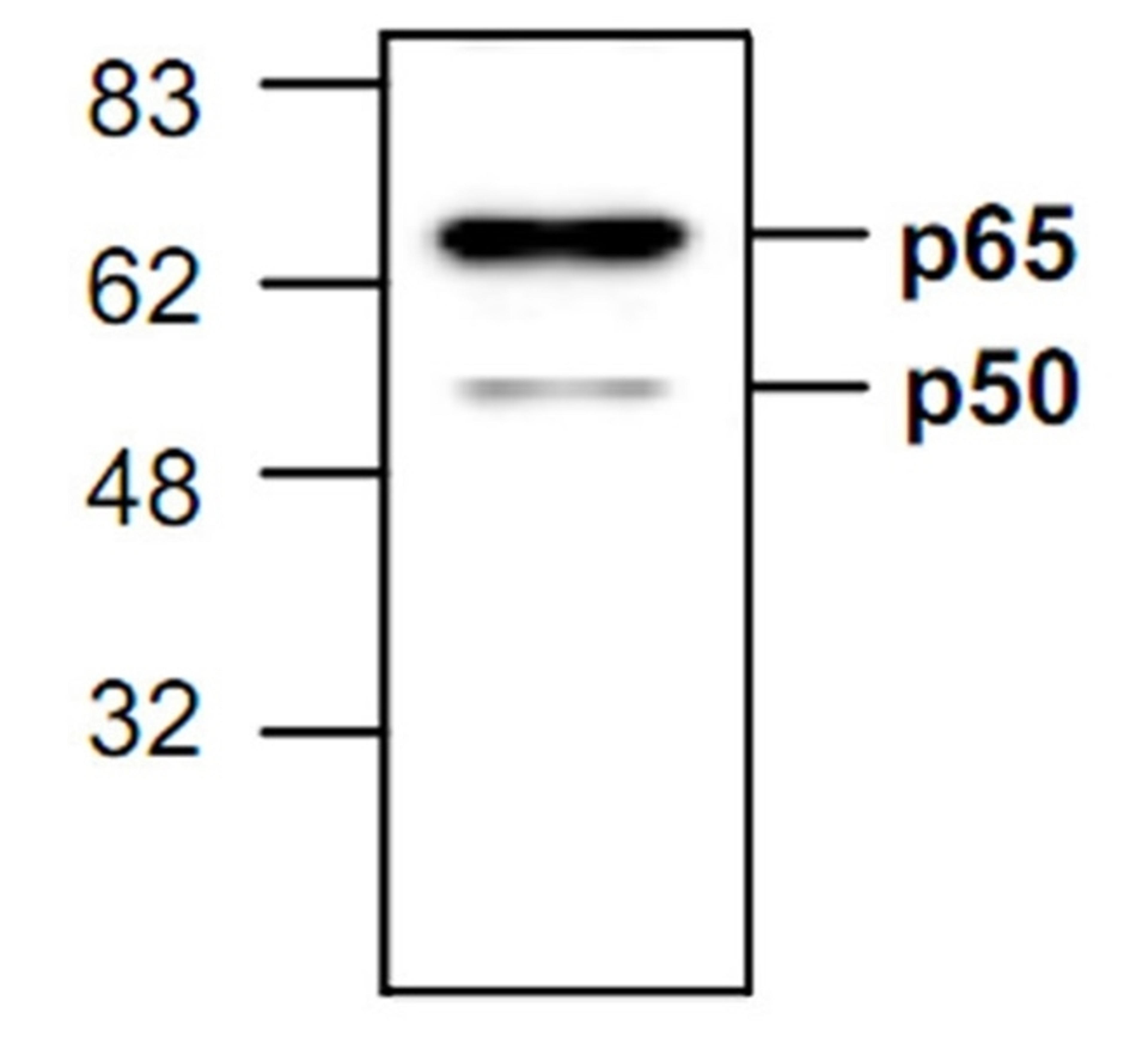 Western blot analysis of Jurkat cell lysate probed with Rabbit anti NFkB p65 antibody