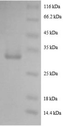 (Tris-Glycine gel) Discontinuous SDS-PAGE (reduced) with 5% enrichment gel and 15% separation gel.