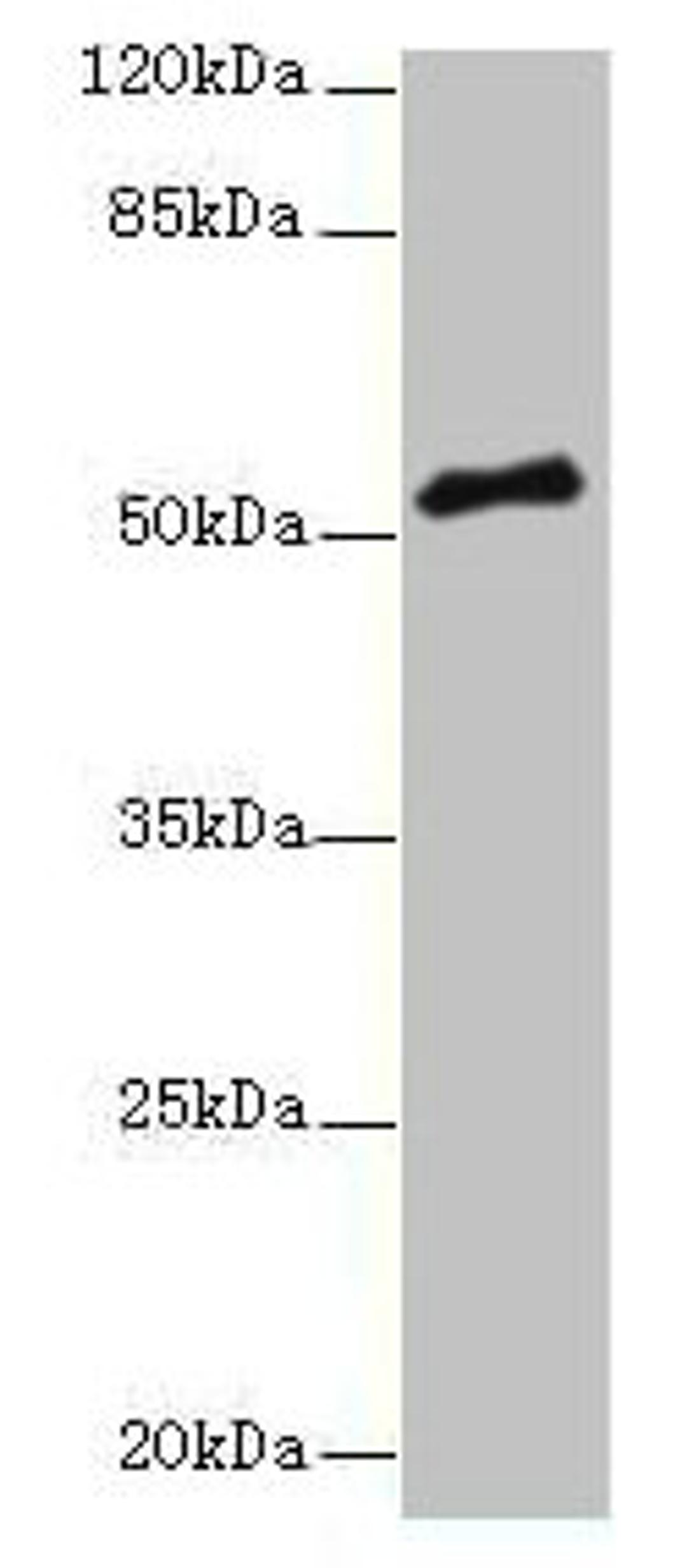 Western blot. All lanes: PLXNA4 antibody at 3µg/ml + A549 whole cell lysate. Secondary. Goat polyclonal to rabbit IgG at 1/10000 dilution. Predicted band size: 213, 56, 59, 40 kDa. Observed band size: 56 kDa