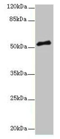 Western blot. All lanes: PLXNA4 antibody at 3µg/ml + A549 whole cell lysate. Secondary. Goat polyclonal to rabbit IgG at 1/10000 dilution. Predicted band size: 213, 56, 59, 40 kDa. Observed band size: 56 kDa