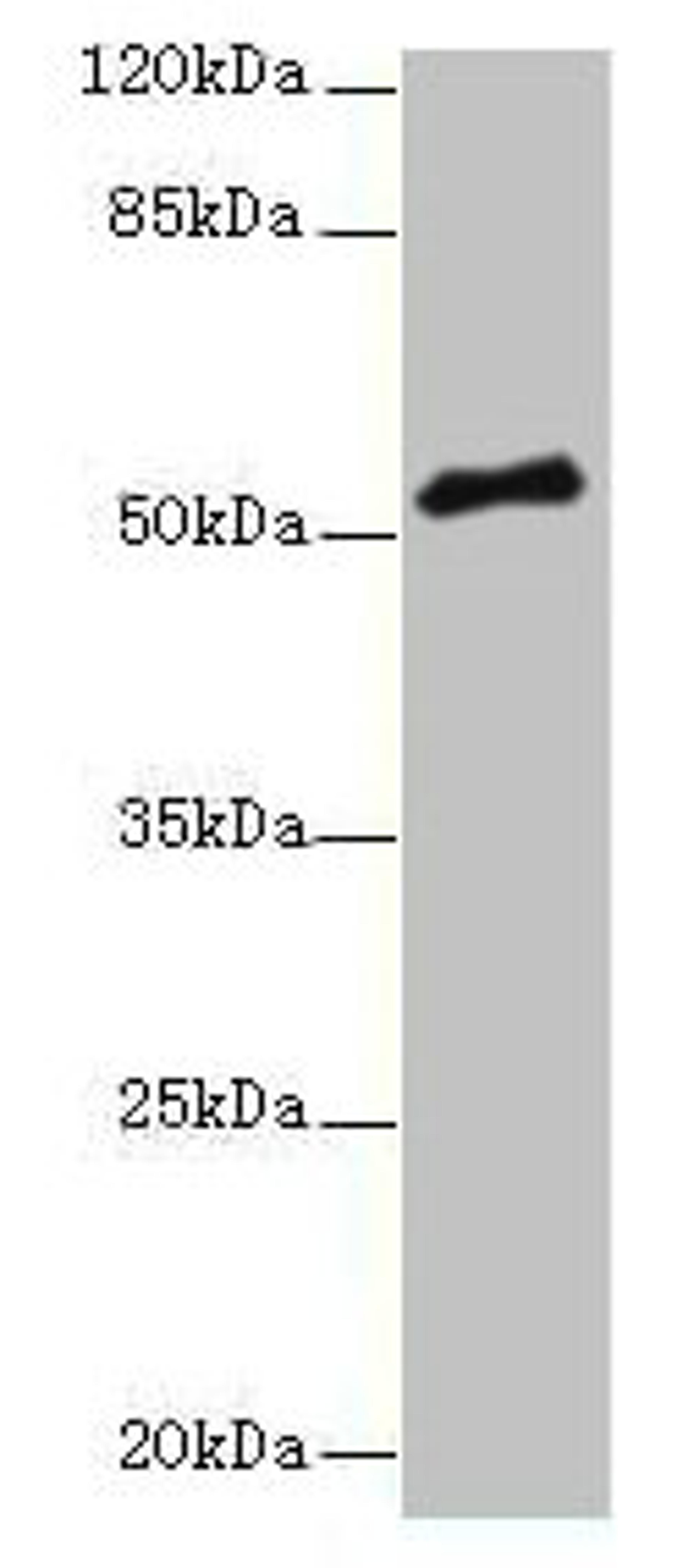 Western blot. All lanes: PLXNA4 antibody at 3µg/ml + A549 whole cell lysate. Secondary. Goat polyclonal to rabbit IgG at 1/10000 dilution. Predicted band size: 213, 56, 59, 40 kDa. Observed band size: 56 kDa