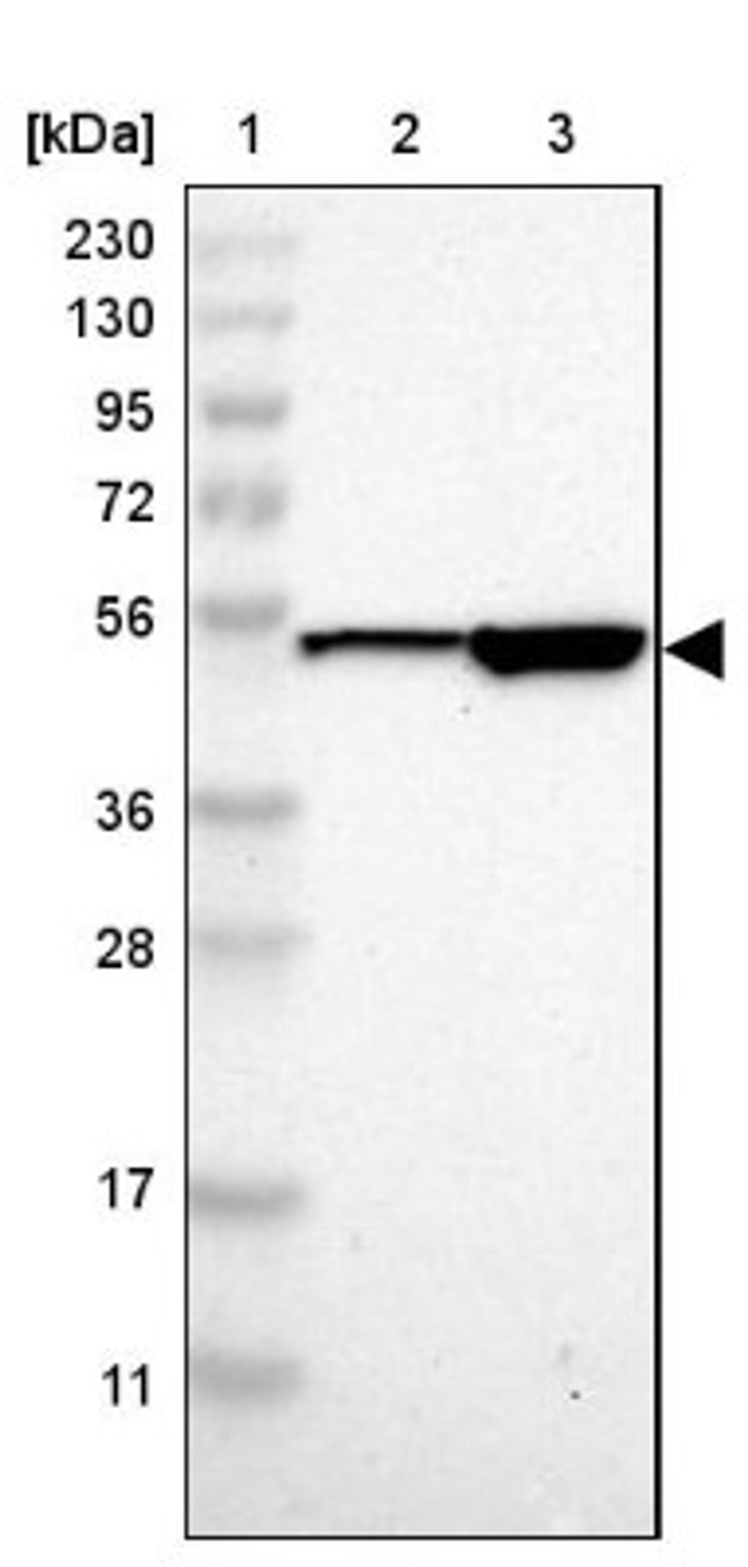 Western Blot: SOX30 Antibody [NBP1-86503] - Lane 1: Marker [kDa] 230, 130, 95, 72, 56, 36, 28, 17, 11<br/>Lane 2: Human cell line RT-4<br/>Lane 3: Human cell line U-251MG sp