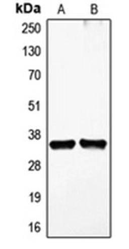 Western blot analysis of HDMEC (Lane 1), HEK293T (Lane 2) whole cell lysates using FIGF antibody