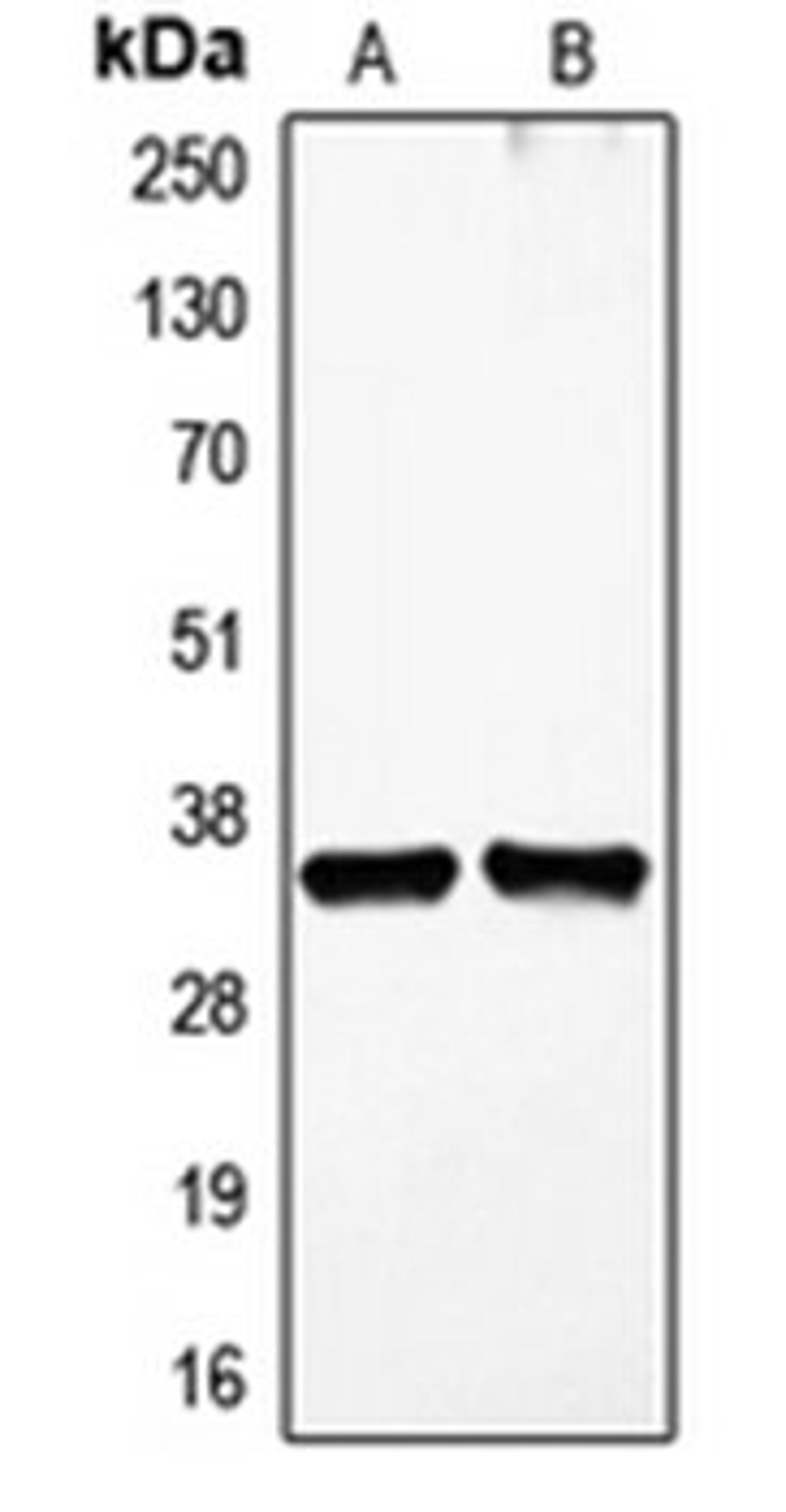 Western blot analysis of HDMEC (Lane 1), HEK293T (Lane 2) whole cell lysates using FIGF antibody