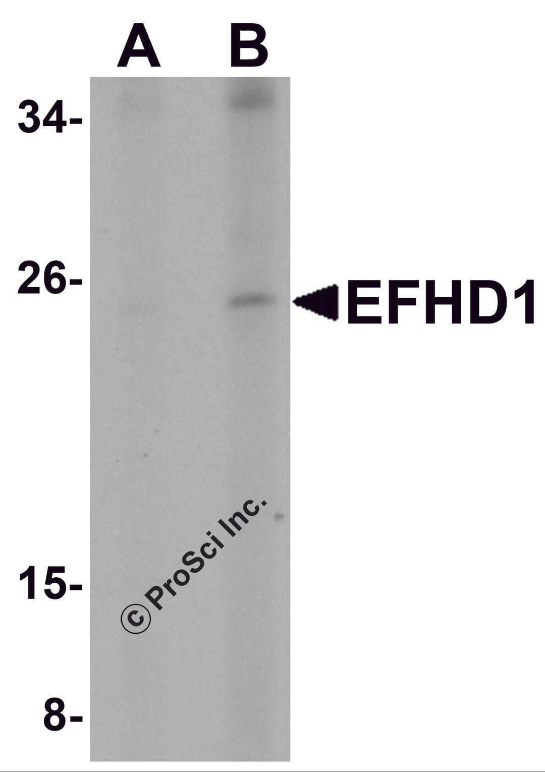 Western blot analysis of EFHD1 in human spleen tissue lysate with EFHD1 antibody at (A) 2 and (B) 4 μg/mL.