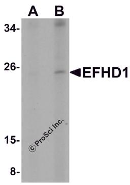 Western blot analysis of EFHD1 in human spleen tissue lysate with EFHD1 antibody at (A) 2 and (B) 4 μg/mL.