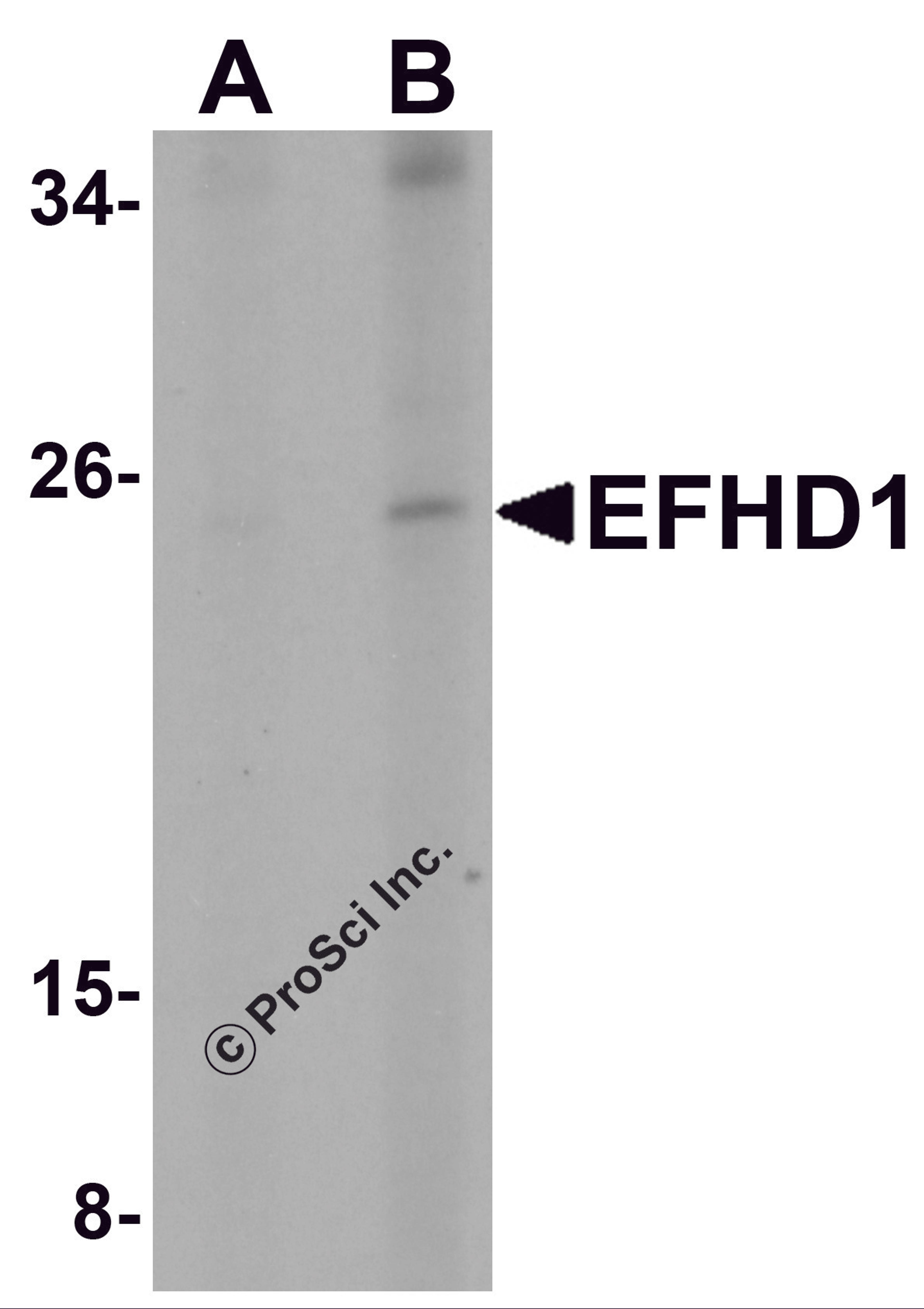 Western blot analysis of EFHD1 in human spleen tissue lysate with EFHD1 antibody at (A) 2 and (B) 4 μg/mL.