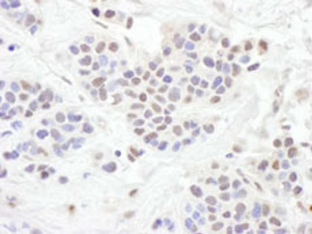 Detection of human TLE1 by immunohistochemistry.