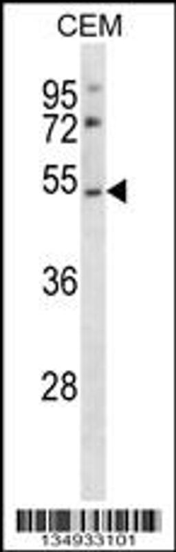 Western blot analysis in CEM cell line lysates (35ug/lane).