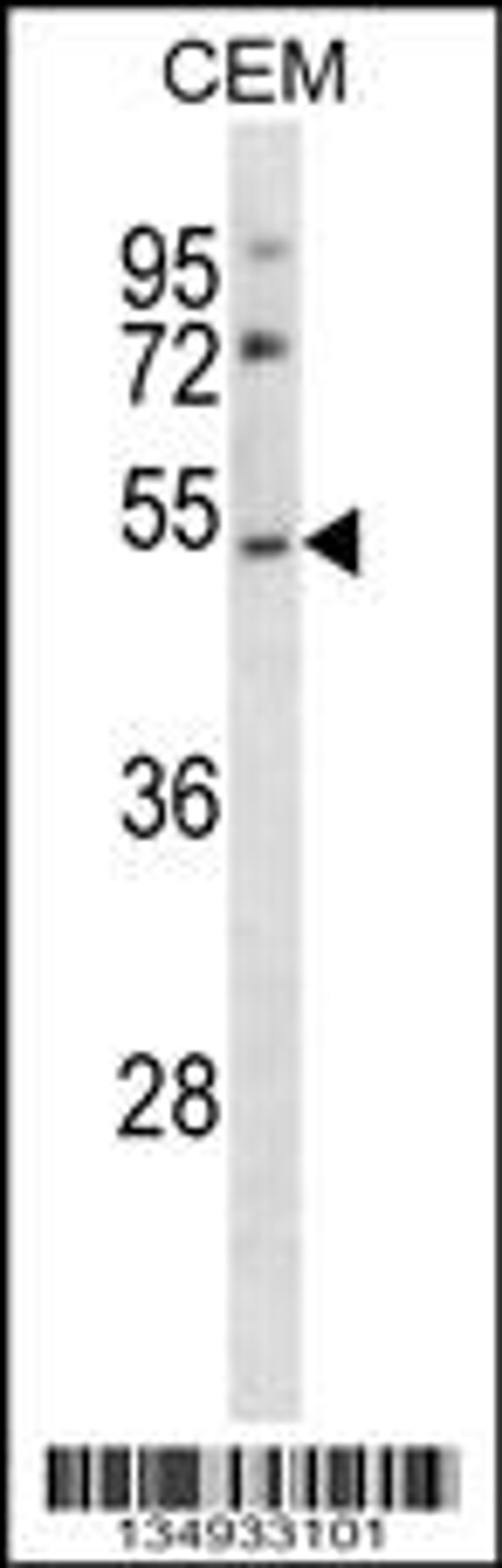 Western blot analysis in CEM cell line lysates (35ug/lane).