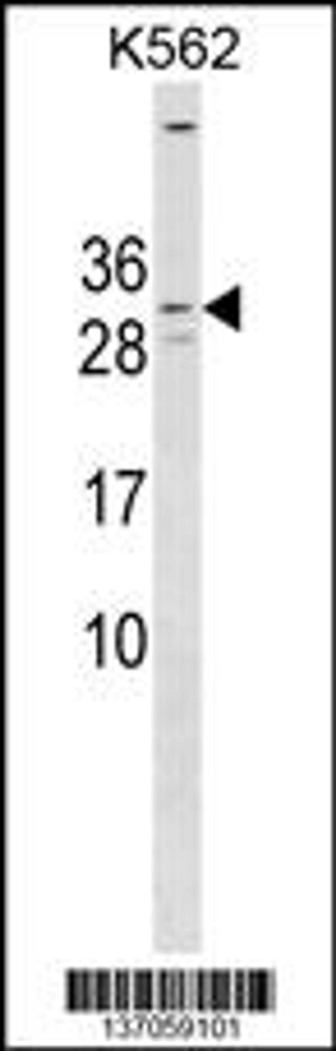 Western blot analysis in K562 cell line lysates (35ug/lane).