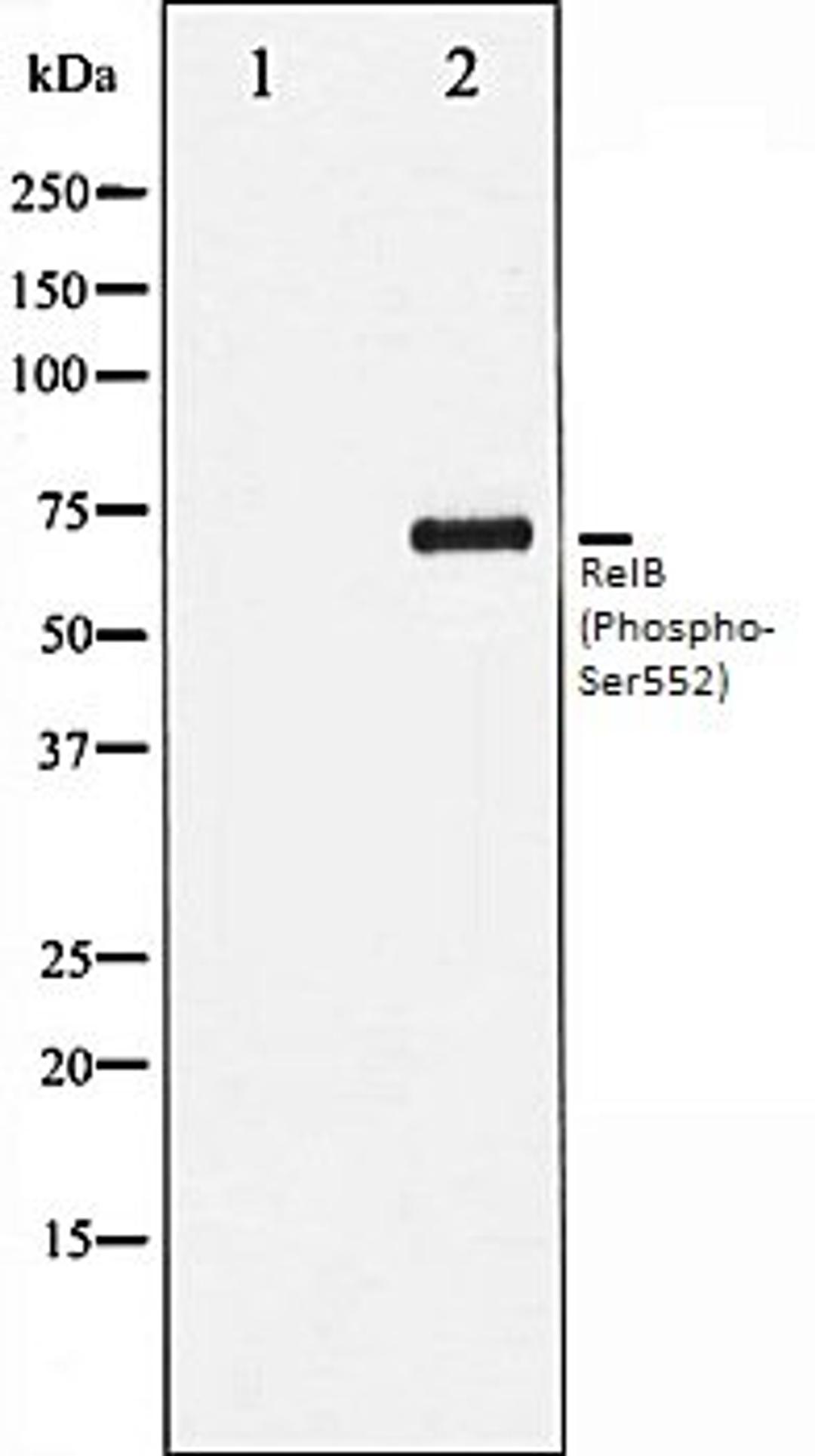 Western blot analysis of HepG2 whole cell lysates using RelB (Phospho-Ser552) antibody, The lane on the left is treated with the antigen-specific peptide.