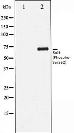 Western blot analysis of HepG2 whole cell lysates using RelB (Phospho-Ser552) antibody, The lane on the left is treated with the antigen-specific peptide.