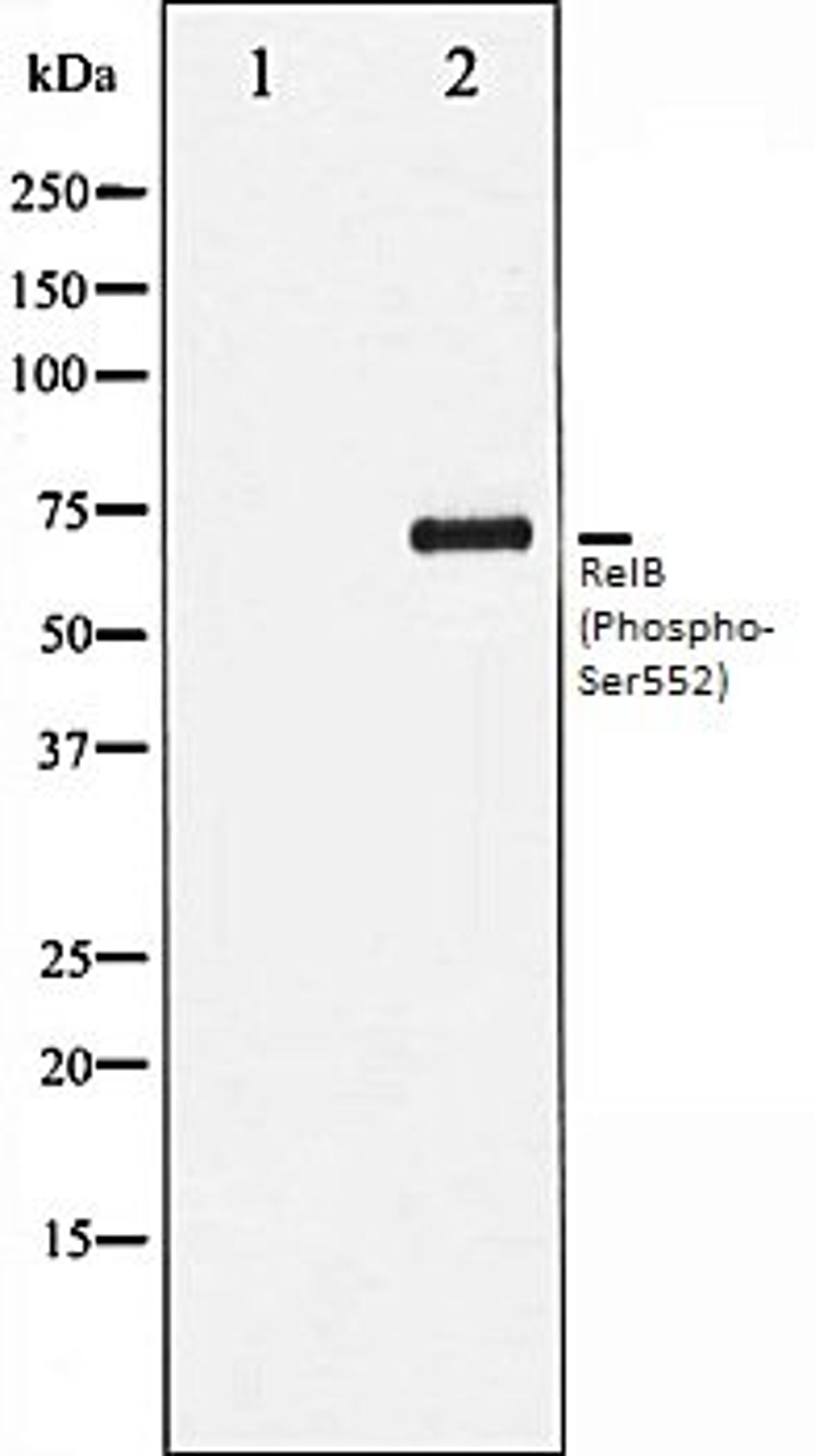 Western blot analysis of HepG2 whole cell lysates using RelB (Phospho-Ser552) antibody, The lane on the left is treated with the antigen-specific peptide.