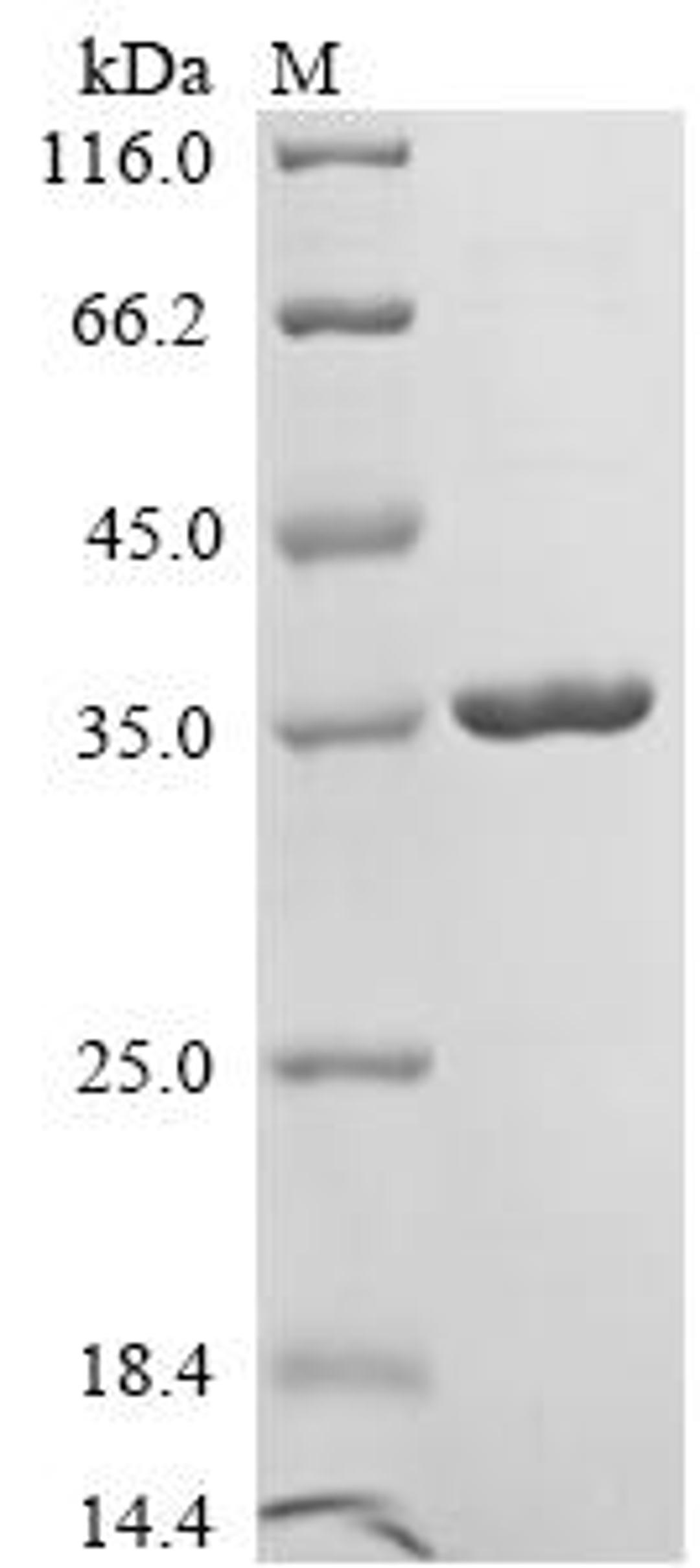 (Tris-Glycine gel) Discontinuous SDS-PAGE (reduced) with 5% enrichment gel and 15% separation gel.