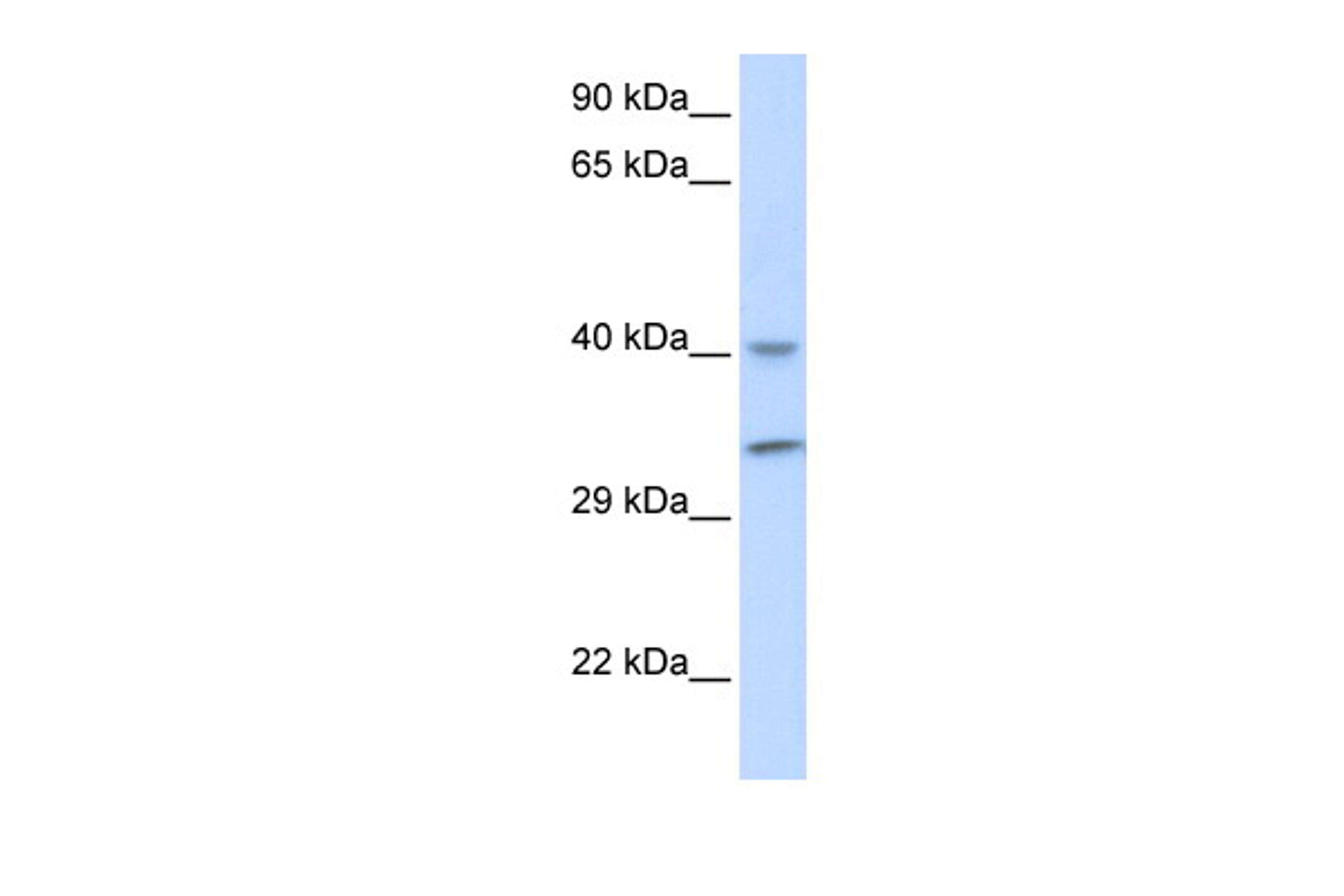 Antibody used in WB on Human Muscle at 0.2-1 ug/ml.