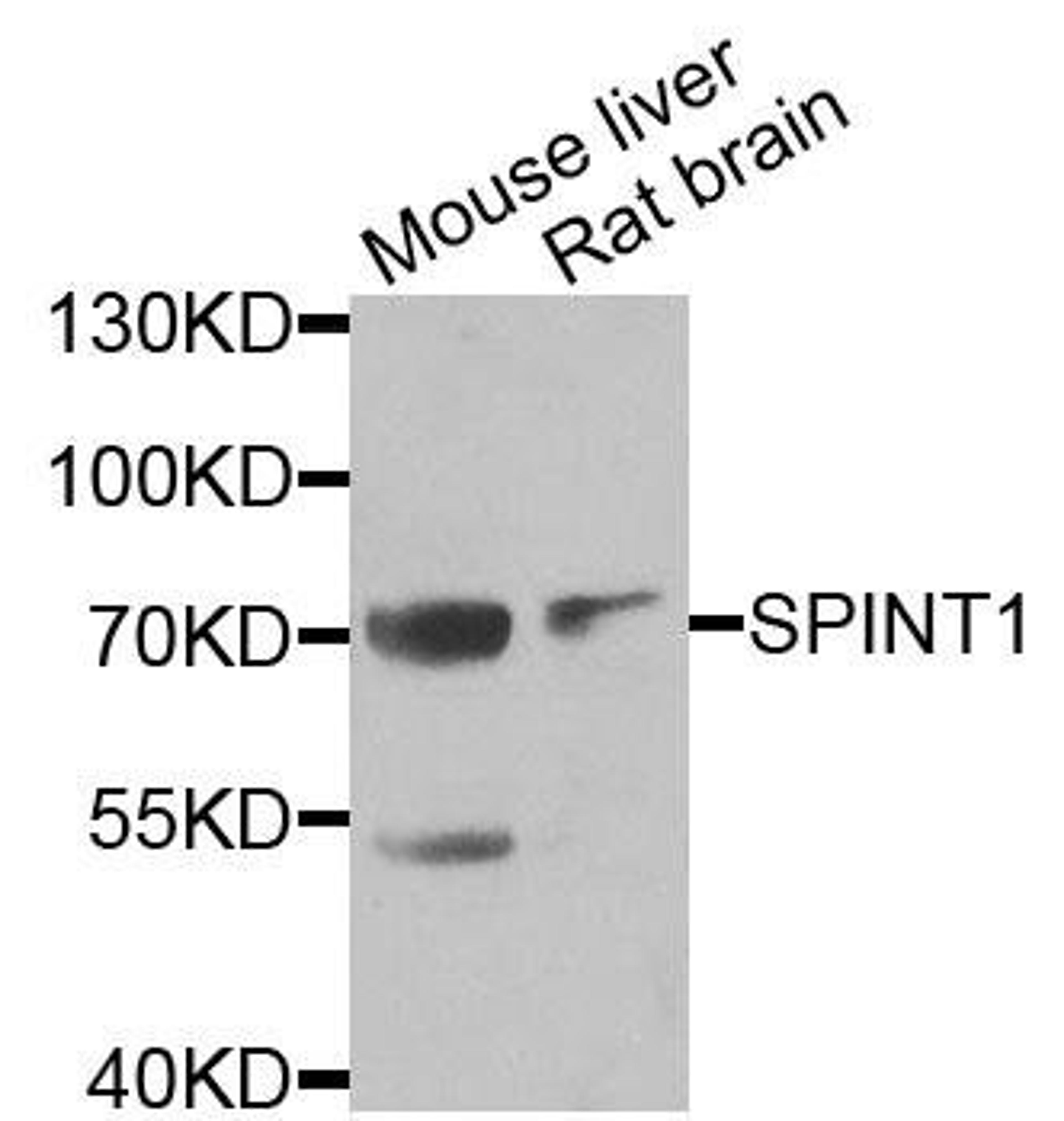 Western blot analysis of extracts of various cells using SPINT1 antibody