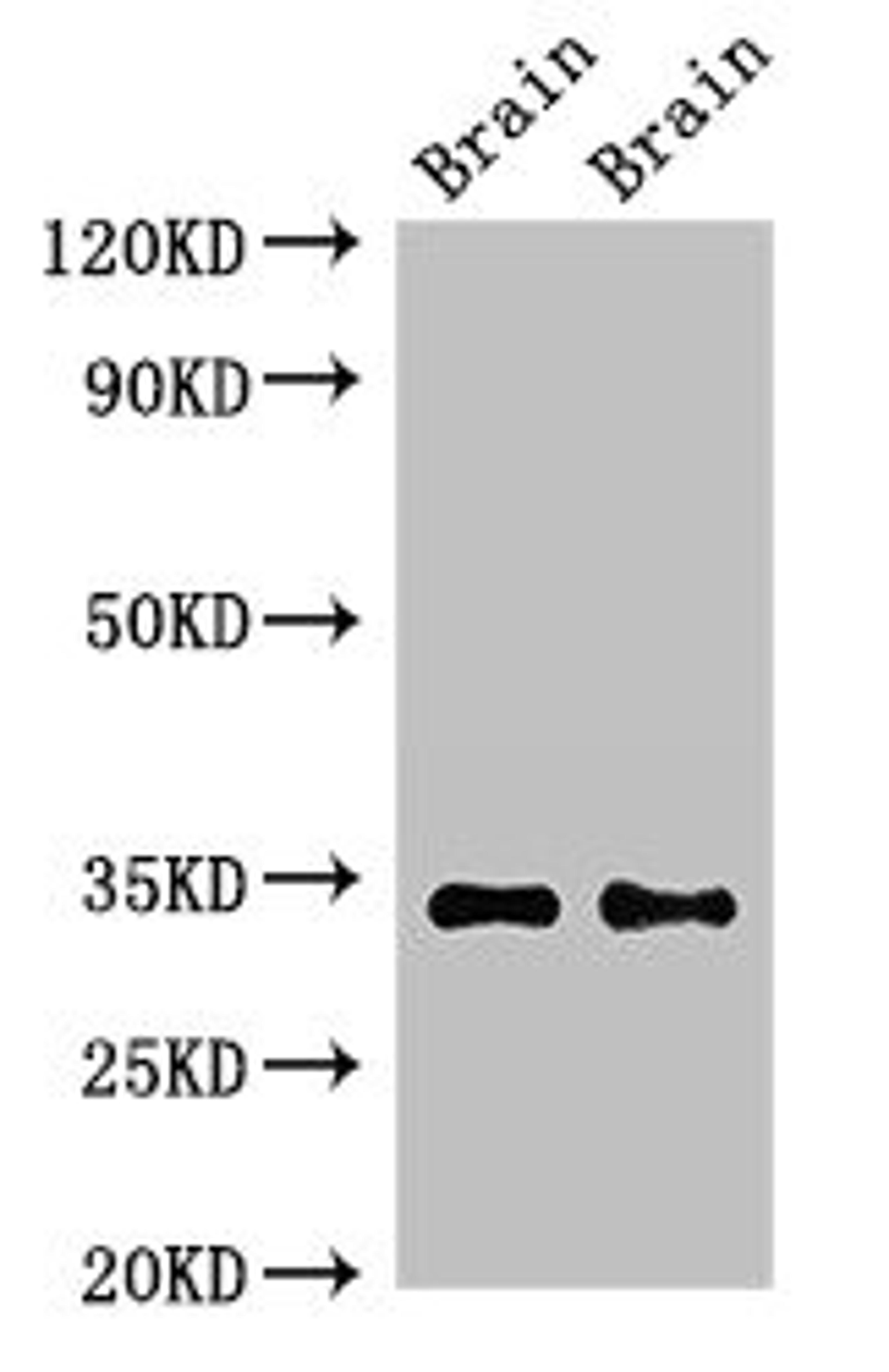 Western Blot. Positive WB detected in: Mouse brain tissue, Rat brain tissue. All lanes: NPY6R antibody at 2.3ug/ml. Secondary. Goat polyclonal to rabbit IgG at 1/50000 dilution. Predicted band size: 34 kDa. Observed band size: 34 kDa. 