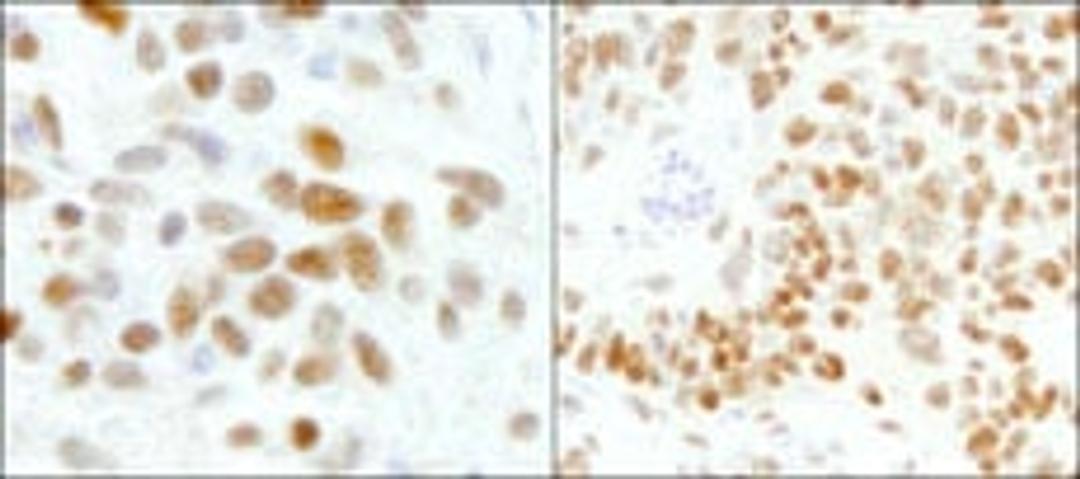 Detection of human and mouse GTF2I/TFII-I by immunohistochemistry.