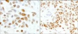 Detection of human and mouse GTF2I/TFII-I by immunohistochemistry.