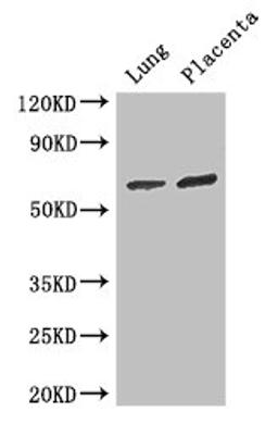 Western Blot. Positive WB detected in: Mouse lung tissue, Human placenta tissue. All lanes: STAU1 antibody at 3ug/ml. Secondary. Goat polyclonal to rabbit IgG at 1/50000 dilution. Predicted band size: 64, 55, 56 kDa. Observed band size: 64 kDa. 