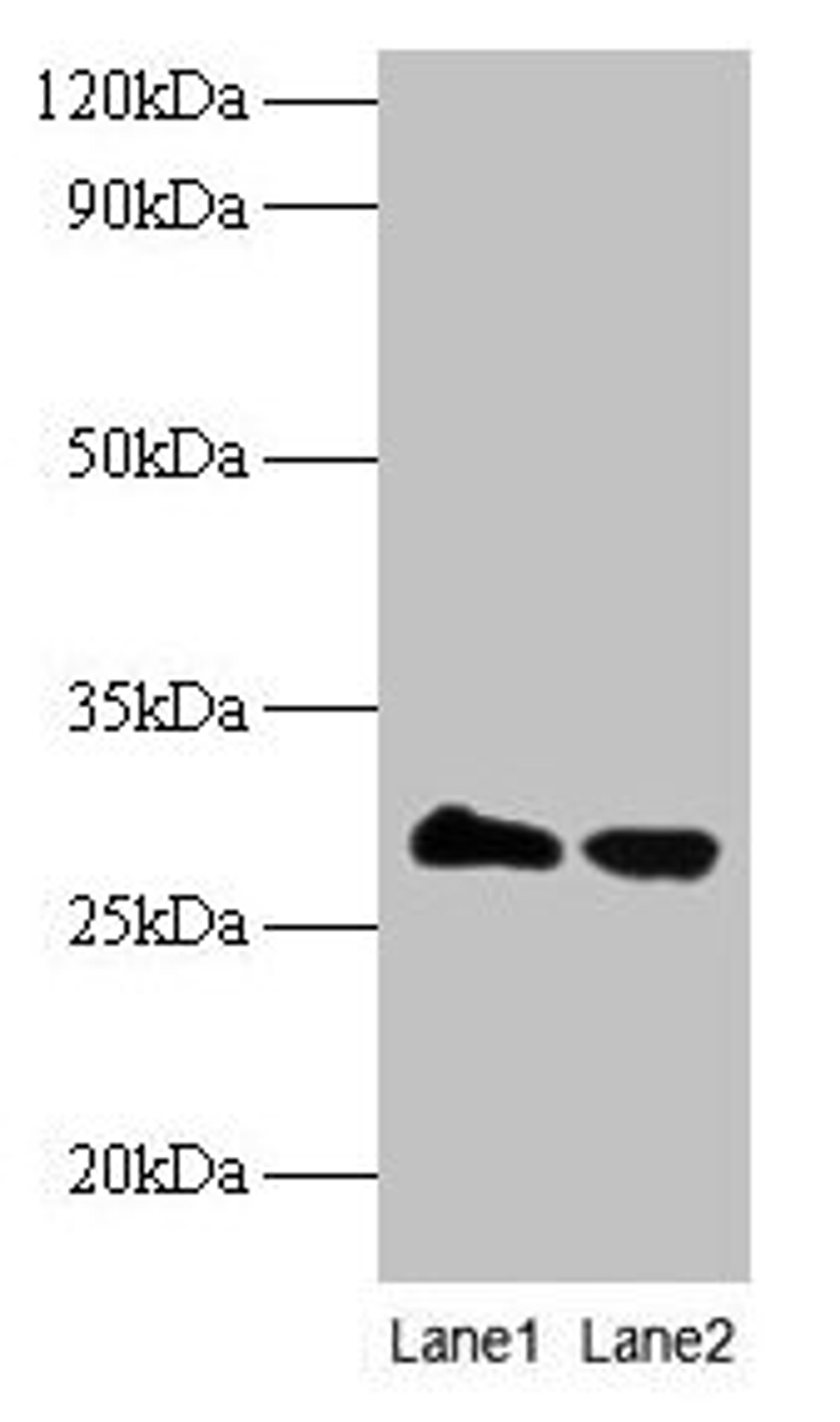 Western blot. All lanes: TPMT antibody at 2µg/ml. Lane 1: EC109 whole cell lysate. Lane 2: 293T whole cell lysate. Secondary. Goat polyclonal to rabbit IgG at 1/15000 dilution. Predicted band size: 29 kDa. Observed band size: 29 kDa