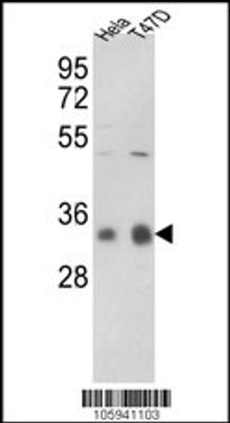 Western blot analysis of hPPP1CC-A306 in Hela, T47D cell line lysates (35ug/lane)